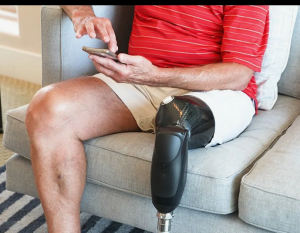 Преимущества электронных коленных модулей в протезировании на уровне бедра