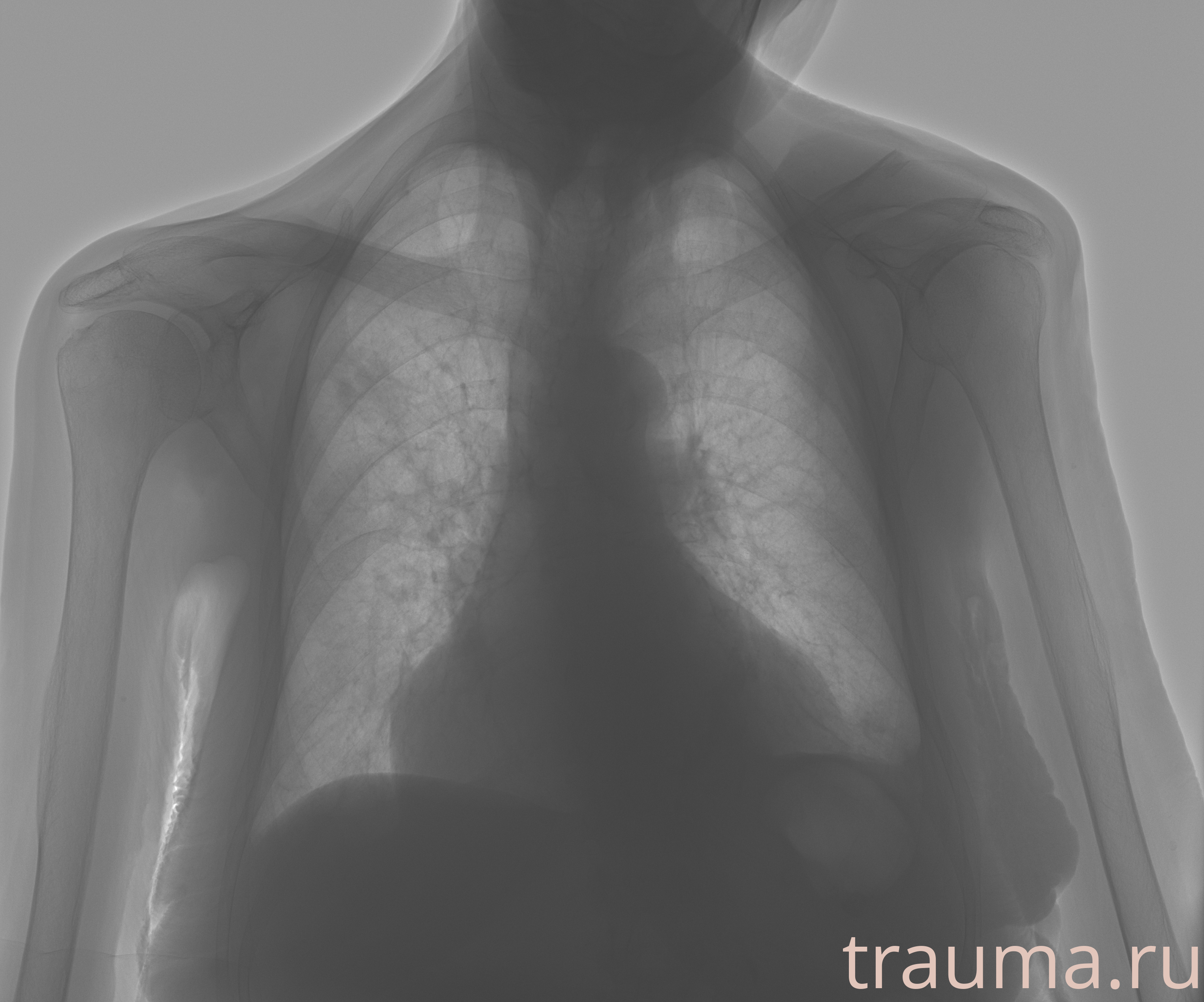 Рентген на дому: по вашему адресу приезжает врач-рентгенолог, травматолог-ортопед с мобильным рентгеновским аппаратом, проводит диагностику травмы или заболевания, делает необходимые рентгенограммы, дает рекомендации по дальнейшему лечению. Получить качественные снимки в домашних условиях возможно благодаря уникальной методике, разработанной МосРентген Центром для института  Склифосовского