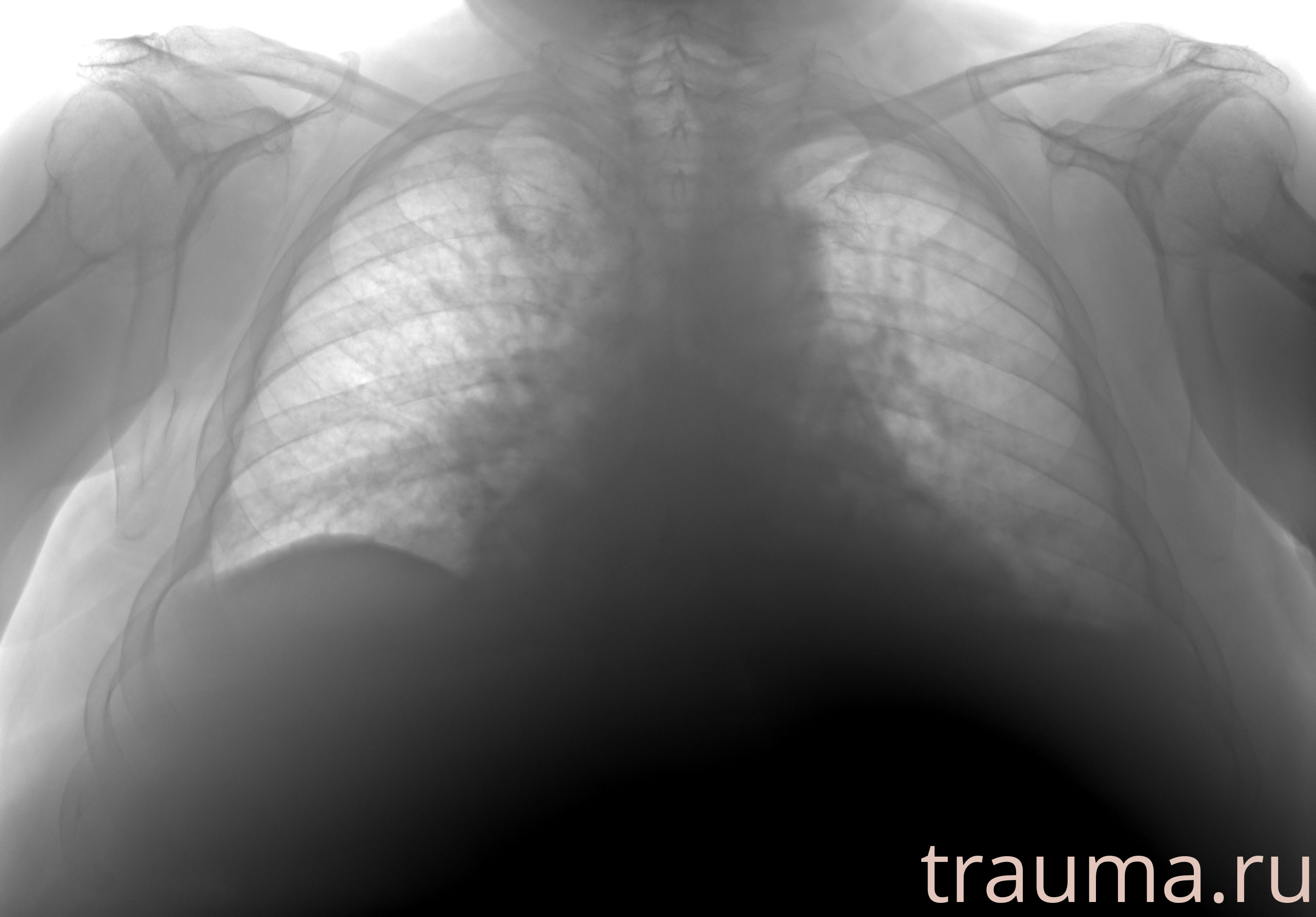 Рентген на дому: по вашему адресу приезжает врач-рентгенолог, травматолог-ортопед с мобильным рентгеновским аппаратом, проводит диагностику травмы или заболевания, делает необходимые рентгенограммы, дает рекомендации по дальнейшему лечению. Получить качественные снимки в домашних условиях возможно благодаря уникальной методике, разработанной МосРентген Центром для института  Склифосовского