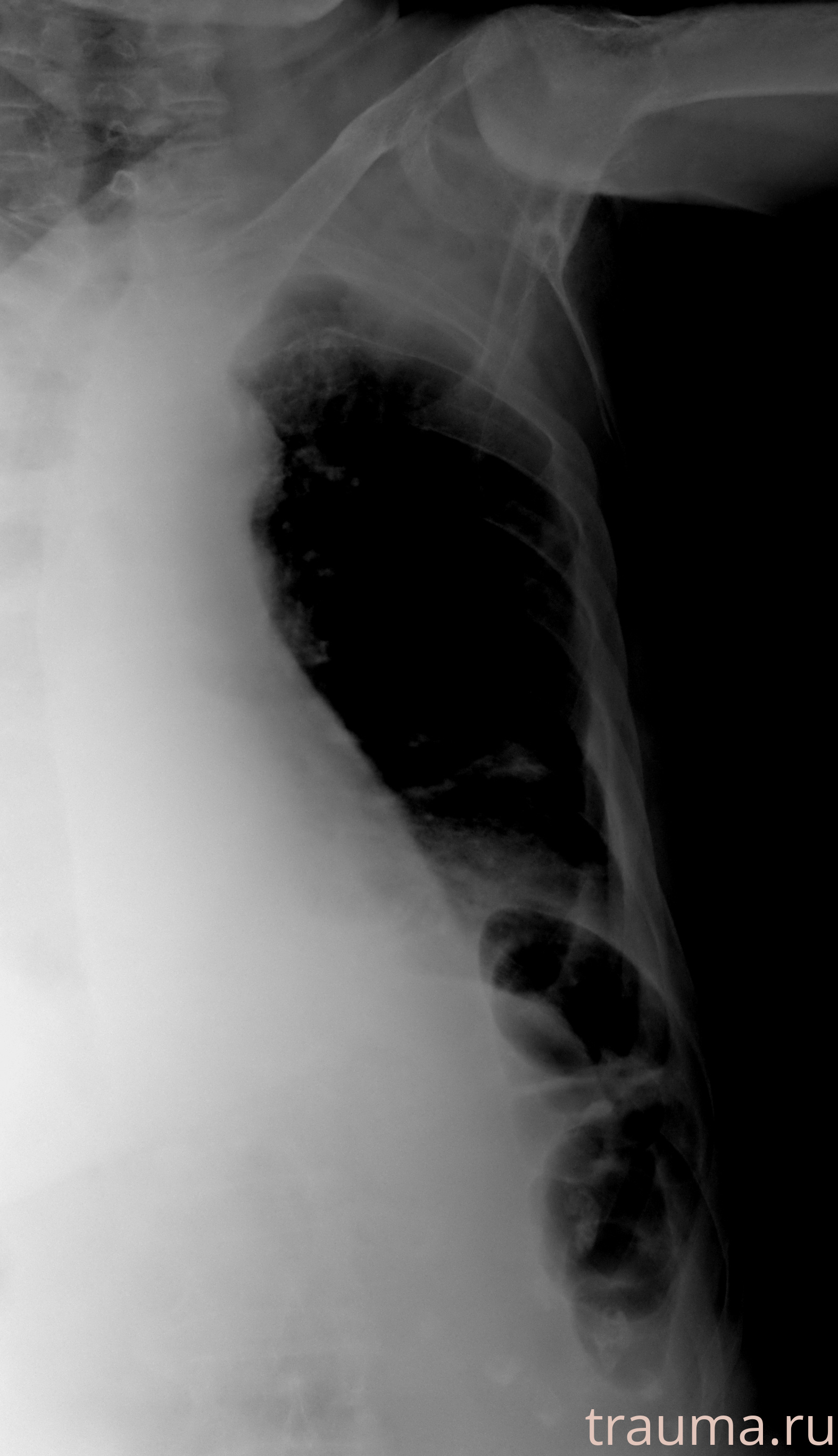 Рентген на дому: по вашему адресу приезжает врач-рентгенолог, травматолог-ортопед с мобильным рентгеновским аппаратом, проводит диагностику травмы или заболевания, делает необходимые рентгенограммы, дает рекомендации по дальнейшему лечению. Получить качественные снимки в домашних условиях возможно благодаря уникальной методике, разработанной МосРентген Центром для института  Склифосовского