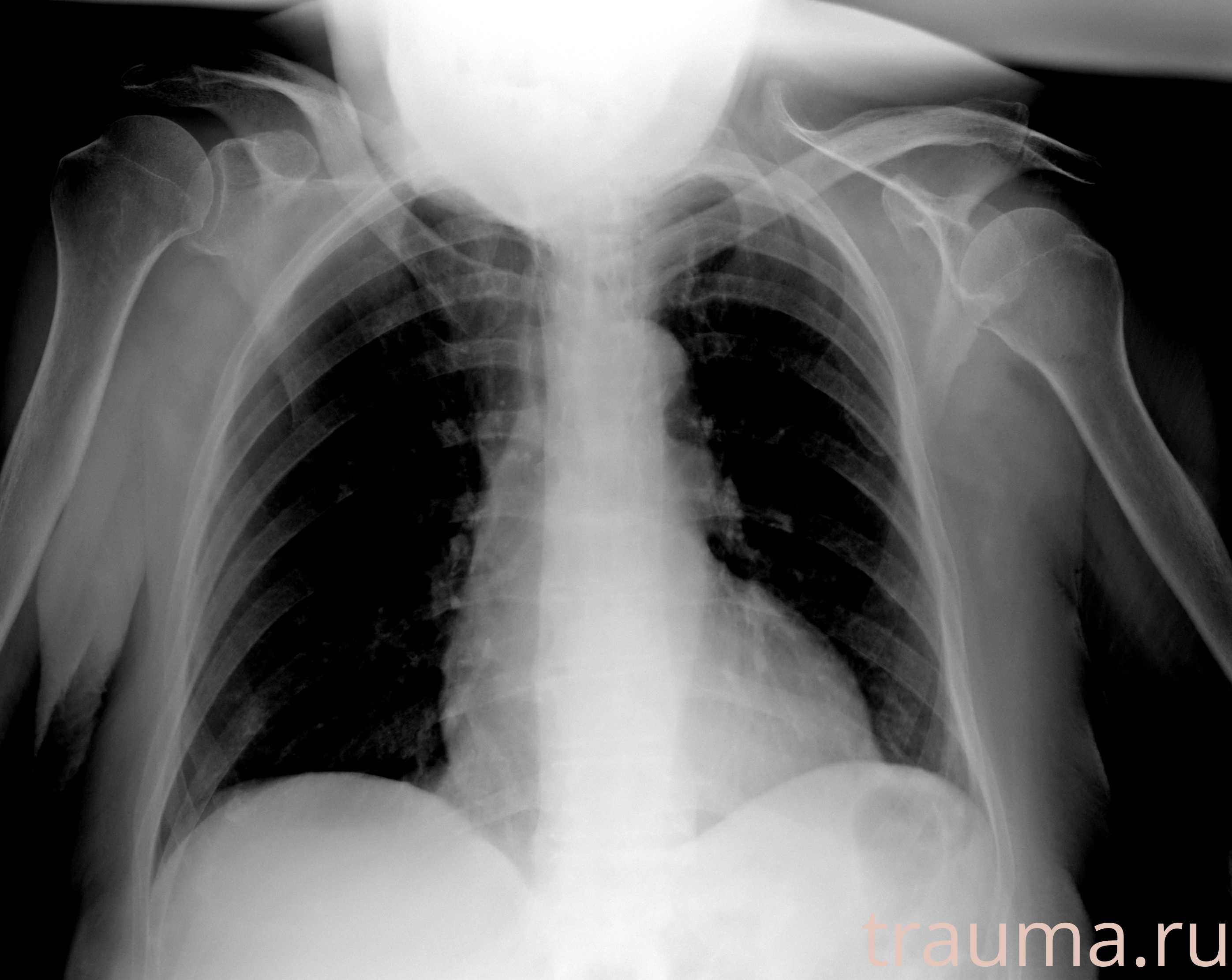 Рентген на дому: по вашему адресу приезжает врач-рентгенолог, травматолог-ортопед с мобильным рентгеновским аппаратом, проводит диагностику травмы или заболевания, делает необходимые рентгенограммы, дает рекомендации по дальнейшему лечению. Получить качественные снимки в домашних условиях возможно благодаря уникальной методике, разработанной МосРентген Центром для института  Склифосовского