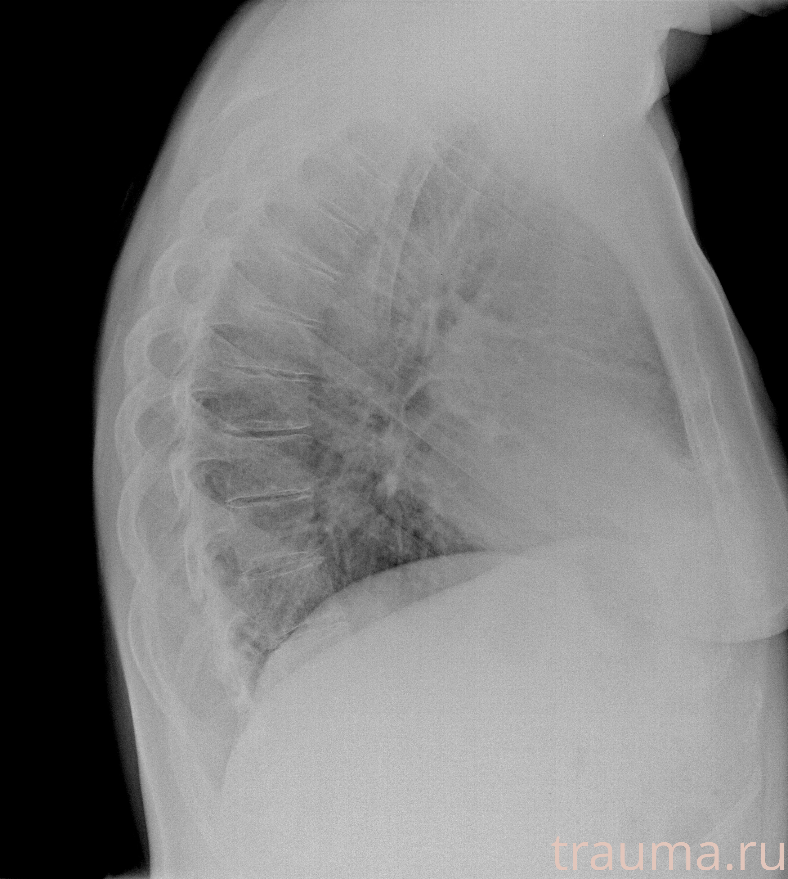 Рентген на дому: по вашему адресу приезжает врач-рентгенолог, травматолог-ортопед с мобильным рентгеновским аппаратом, проводит диагностику травмы или заболевания, делает необходимые рентгенограммы, дает рекомендации по дальнейшему лечению. Получить качественные снимки в домашних условиях возможно благодаря уникальной методике, разработанной МосРентген Центром для института  Склифосовского