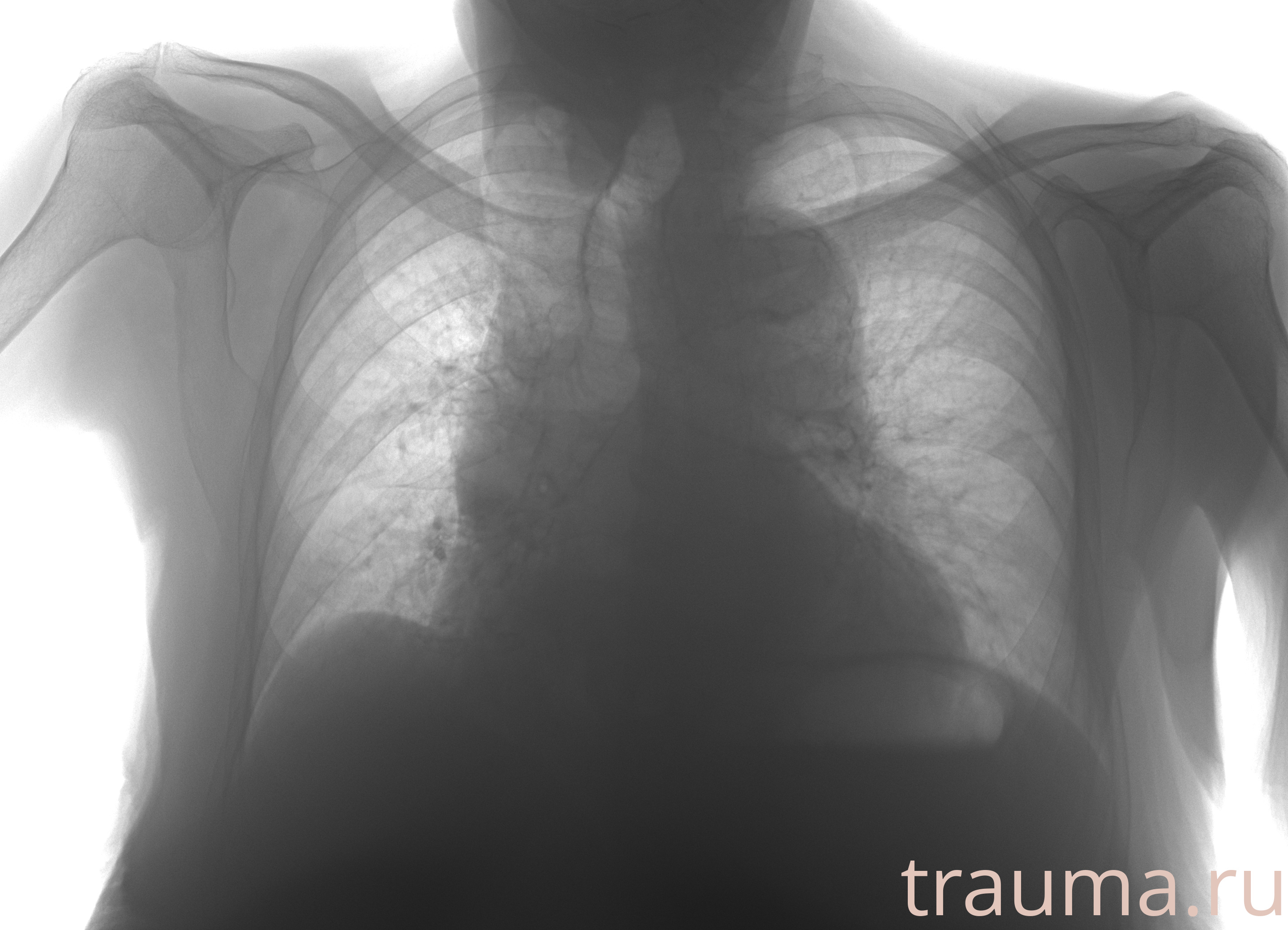 Рентген на дому: по вашему адресу приезжает врач-рентгенолог, травматолог-ортопед с мобильным рентгеновским аппаратом, проводит диагностику травмы или заболевания, делает необходимые рентгенограммы, дает рекомендации по дальнейшему лечению. Получить качественные снимки в домашних условиях возможно благодаря уникальной методике, разработанной МосРентген Центром для института  Склифосовского