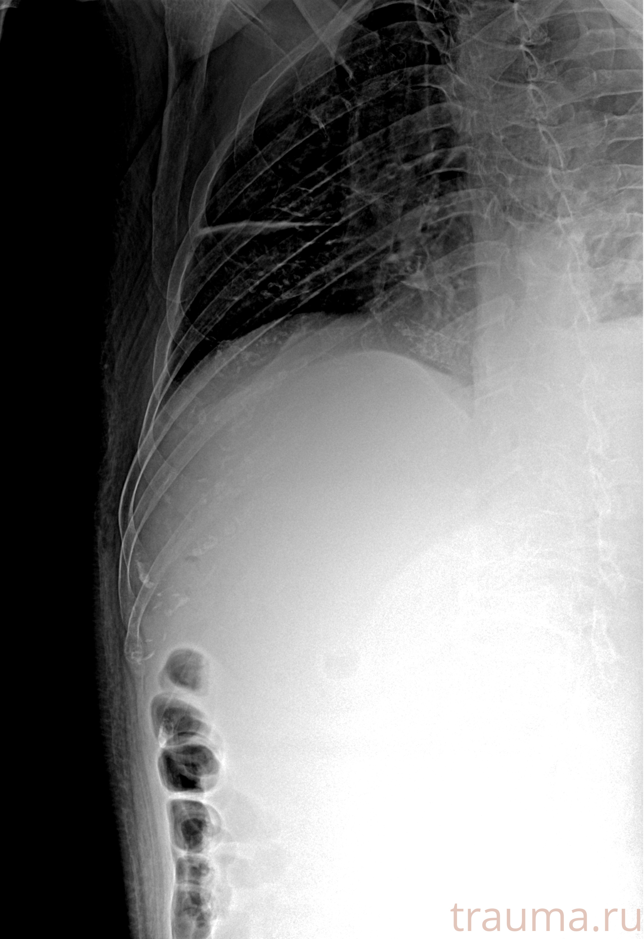 Рентген на дому: по вашему адресу приезжает врач-рентгенолог, травматолог-ортопед с мобильным рентгеновским аппаратом, проводит диагностику травмы или заболевания, делает необходимые рентгенограммы, дает рекомендации по дальнейшему лечению. Получить качественные снимки в домашних условиях возможно благодаря уникальной методике, разработанной МосРентген Центром для института  Склифосовского