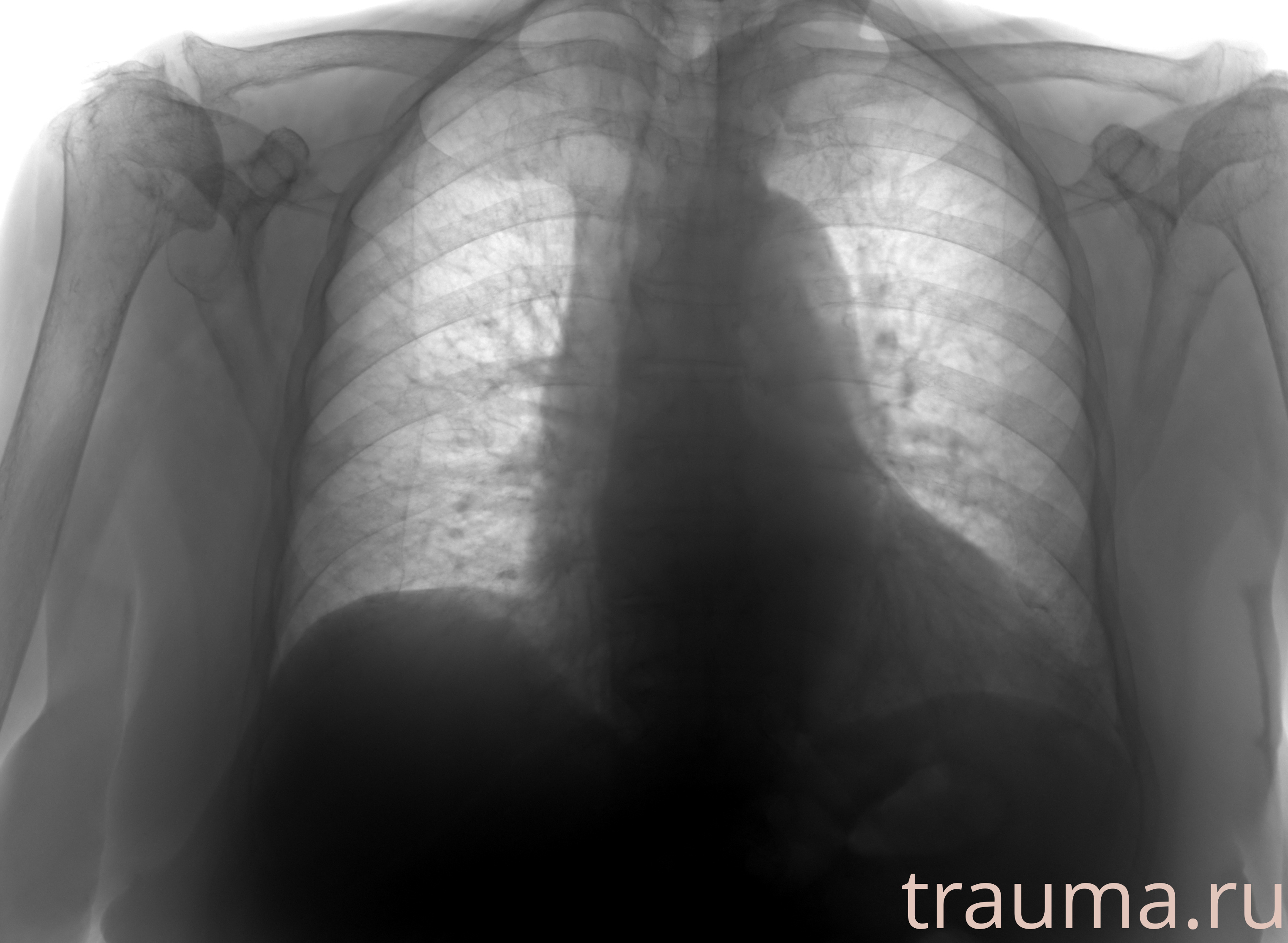 Рентген на дому: по вашему адресу приезжает врач-рентгенолог, травматолог-ортопед с мобильным рентгеновским аппаратом, проводит диагностику травмы или заболевания, делает необходимые рентгенограммы, дает рекомендации по дальнейшему лечению. Получить качественные снимки в домашних условиях возможно благодаря уникальной методике, разработанной МосРентген Центром для института  Склифосовского