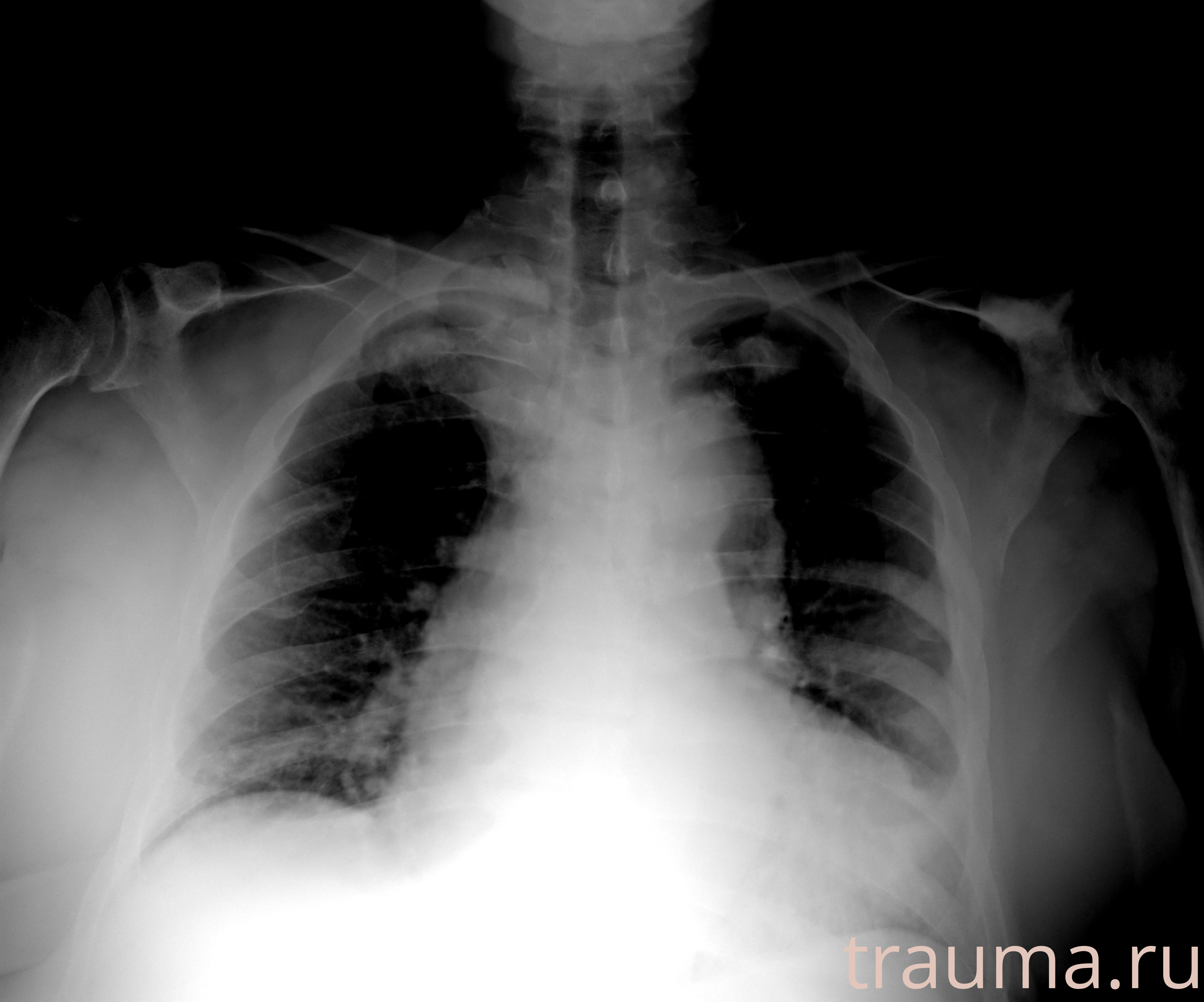 Рентген на дому: по вашему адресу приезжает врач-рентгенолог, травматолог-ортопед с мобильным рентгеновским аппаратом, проводит диагностику травмы или заболевания, делает необходимые рентгенограммы, дает рекомендации по дальнейшему лечению. Получить качественные снимки в домашних условиях возможно благодаря уникальной методике, разработанной МосРентген Центром для института  Склифосовского