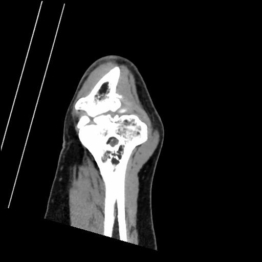 Рентген на дому: по вашему адресу приезжает врач-рентгенолог, травматолог-ортопед с мобильным рентгеновским аппаратом, проводит диагностику травмы или заболевания, делает необходимые рентгенограммы, дает рекомендации по дальнейшему лечению. Получить качественные снимки в домашних условиях возможно благодаря уникальной методике, разработанной МосРентген Центром для института  Склифосовского