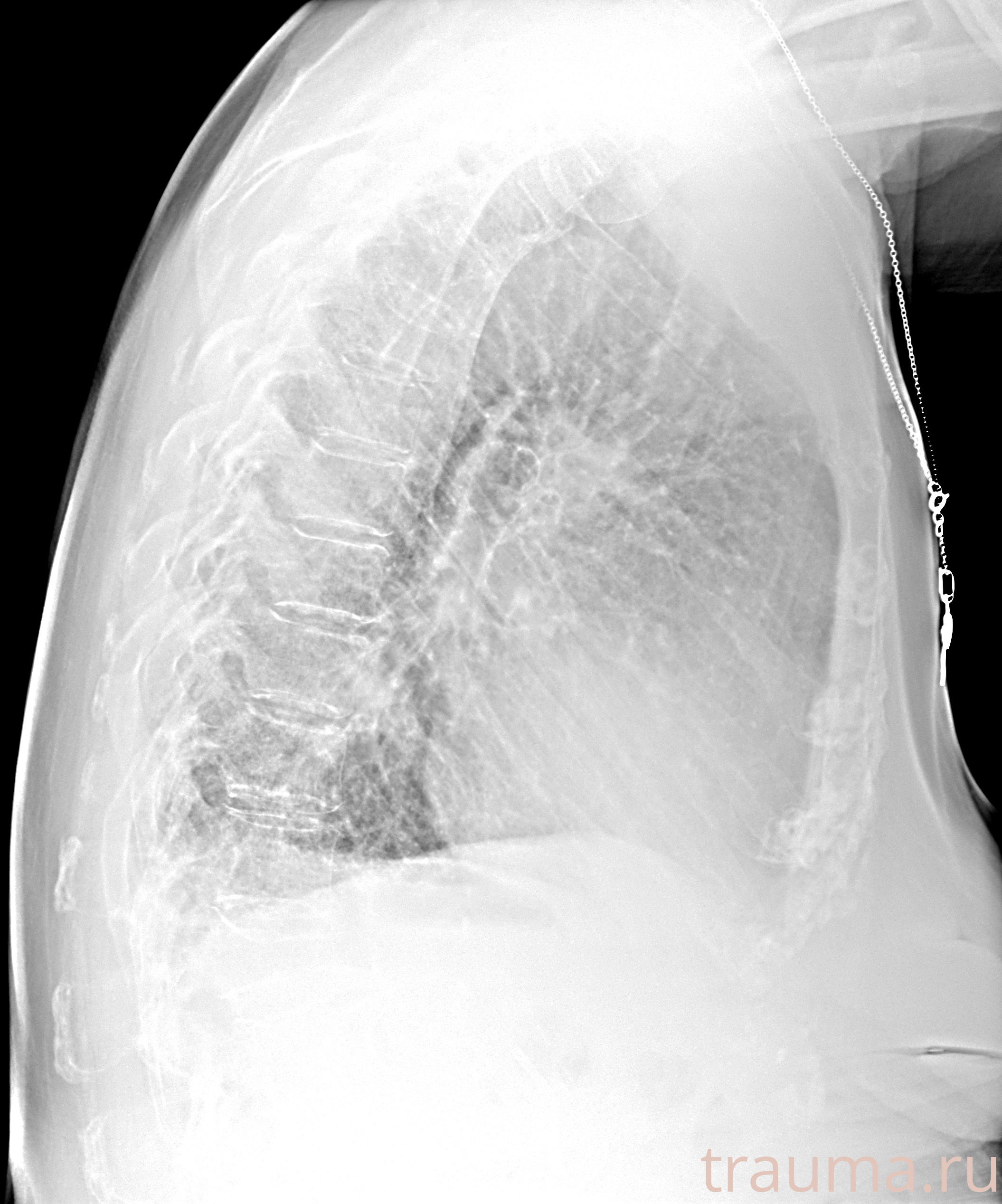 Рентген на дому: по вашему адресу приезжает врач-рентгенолог, травматолог-ортопед с мобильным рентгеновским аппаратом, проводит диагностику травмы или заболевания, делает необходимые рентгенограммы, дает рекомендации по дальнейшему лечению. Получить качественные снимки в домашних условиях возможно благодаря уникальной методике, разработанной МосРентген Центром для института  Склифосовского