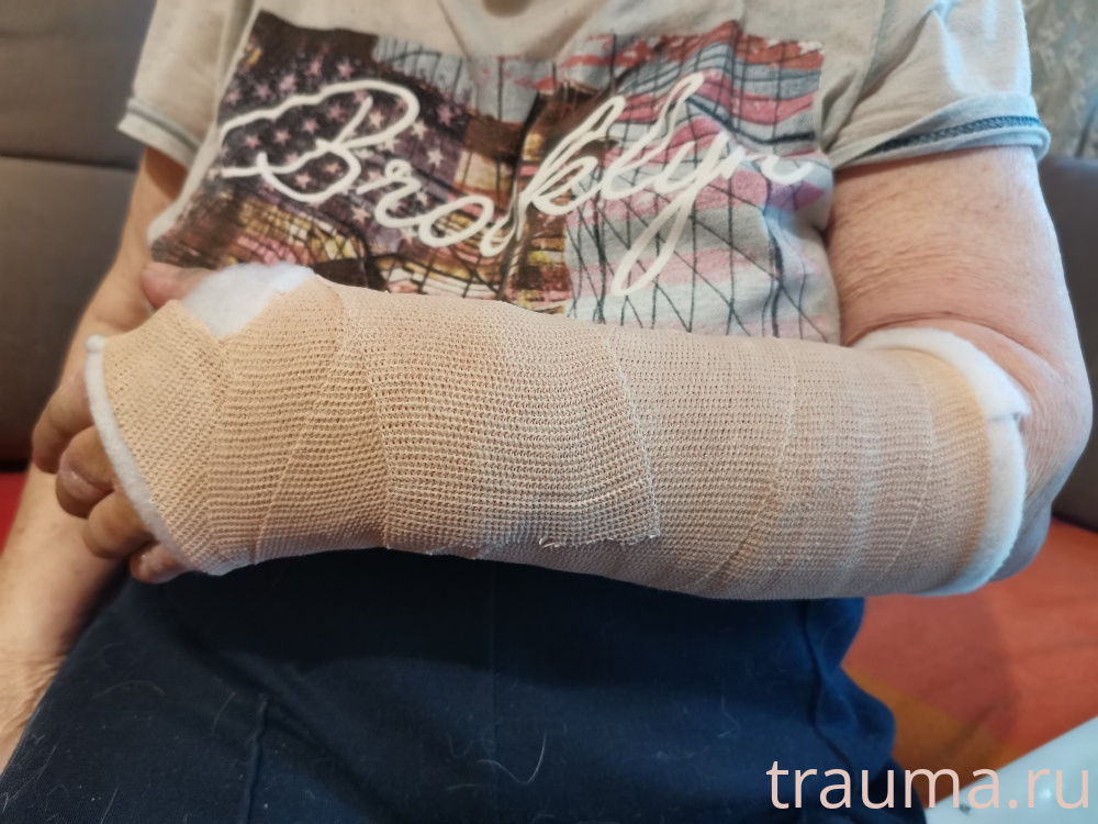 Рентген на дому: по вашему адресу приезжает врач-рентгенолог, травматолог-ортопед с мобильным рентгеновским аппаратом, проводит диагностику травмы или заболевания, делает необходимые рентгенограммы, дает рекомендации по дальнейшему лечению. Получить качественные снимки в домашних условиях возможно благодаря уникальной методике, разработанной МосРентген Центром для института  Склифосовского
