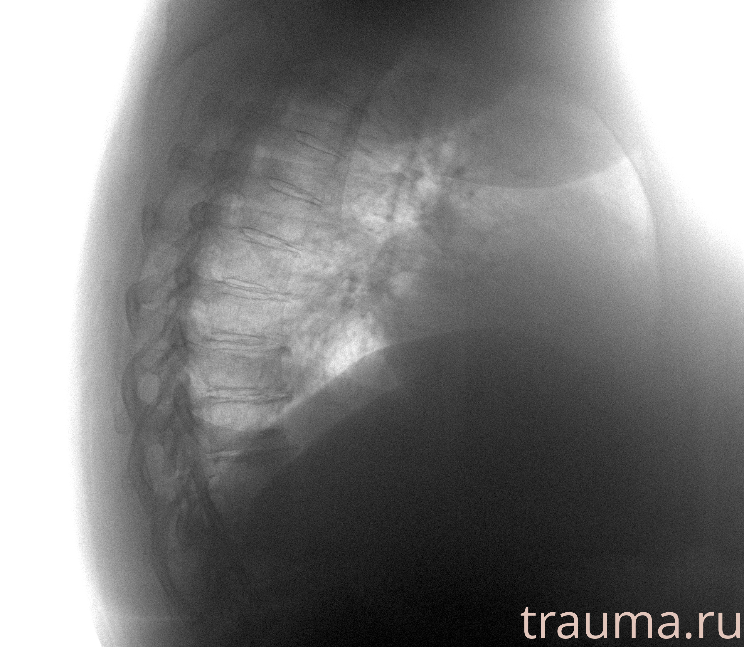 Рентген на дому: по вашему адресу приезжает врач-рентгенолог, травматолог-ортопед с мобильным рентгеновским аппаратом, проводит диагностику травмы или заболевания, делает необходимые рентгенограммы, дает рекомендации по дальнейшему лечению. Получить качественные снимки в домашних условиях возможно благодаря уникальной методике, разработанной МосРентген Центром для института  Склифосовского