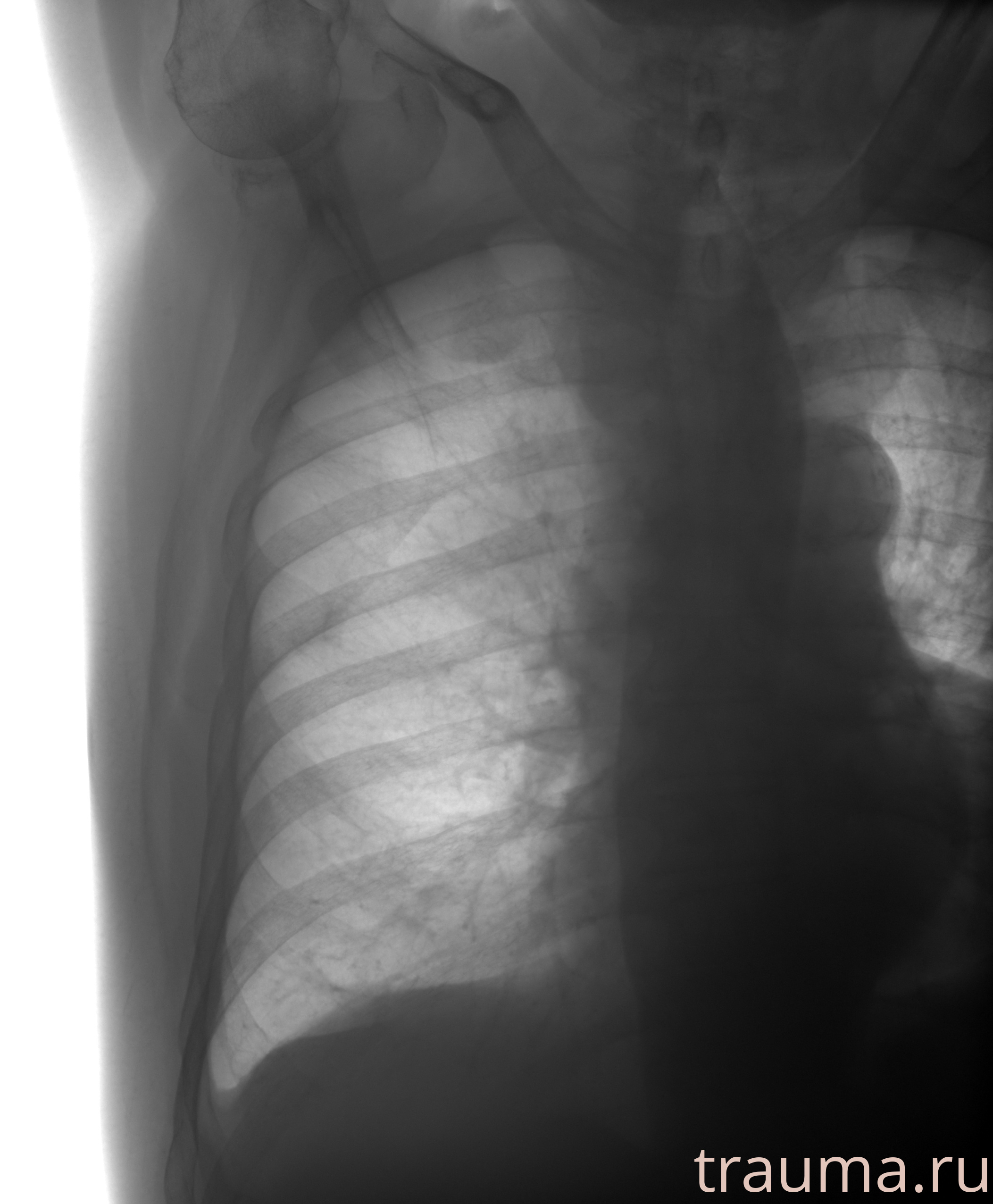 Рентген на дому: по вашему адресу приезжает врач-рентгенолог, травматолог-ортопед с мобильным рентгеновским аппаратом, проводит диагностику травмы или заболевания, делает необходимые рентгенограммы, дает рекомендации по дальнейшему лечению. Получить качественные снимки в домашних условиях возможно благодаря уникальной методике, разработанной МосРентген Центром для института  Склифосовского