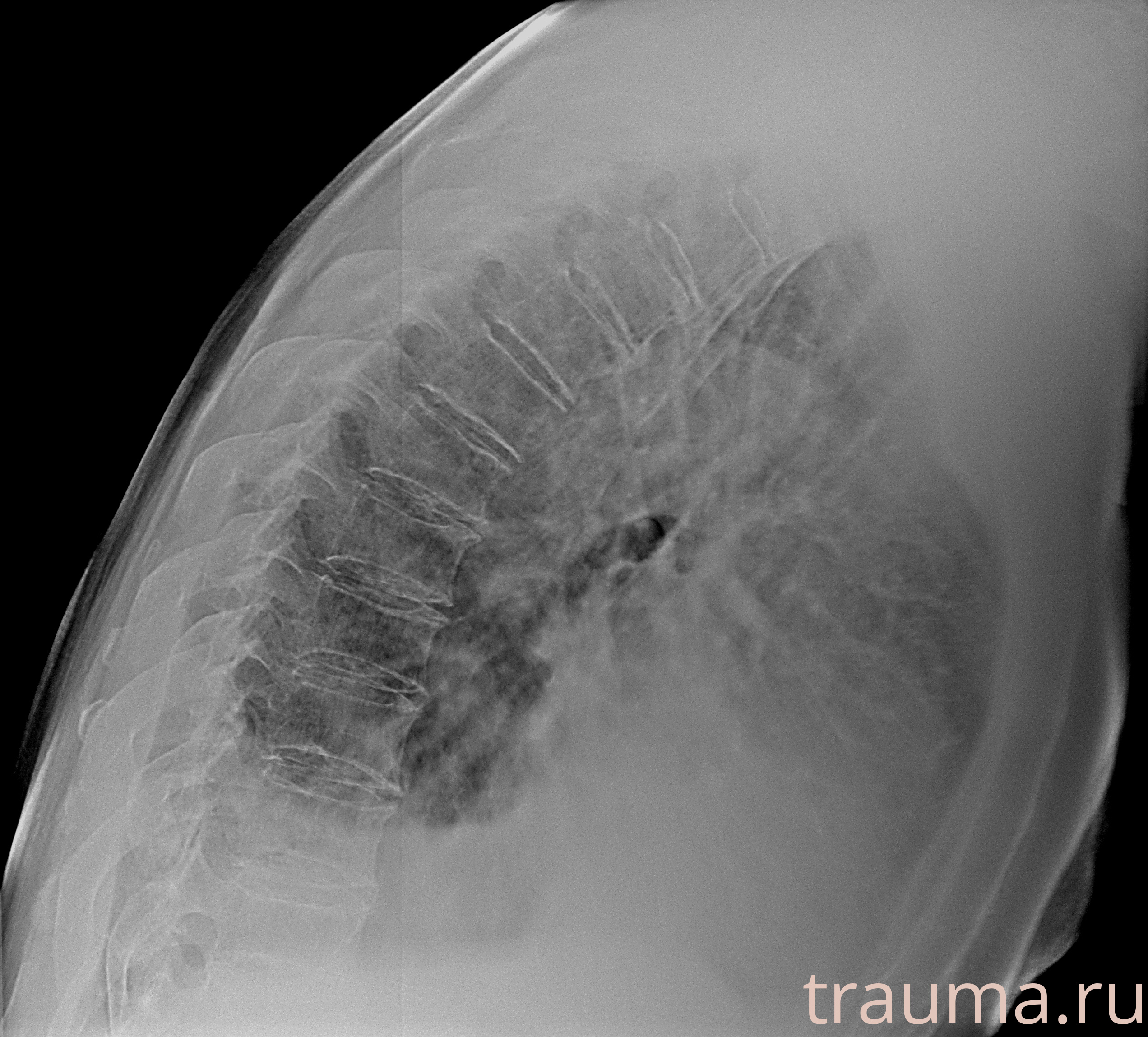 Рентген на дому: по вашему адресу приезжает врач-рентгенолог, травматолог-ортопед с мобильным рентгеновским аппаратом, проводит диагностику травмы или заболевания, делает необходимые рентгенограммы, дает рекомендации по дальнейшему лечению. Получить качественные снимки в домашних условиях возможно благодаря уникальной методике, разработанной МосРентген Центром для института  Склифосовского