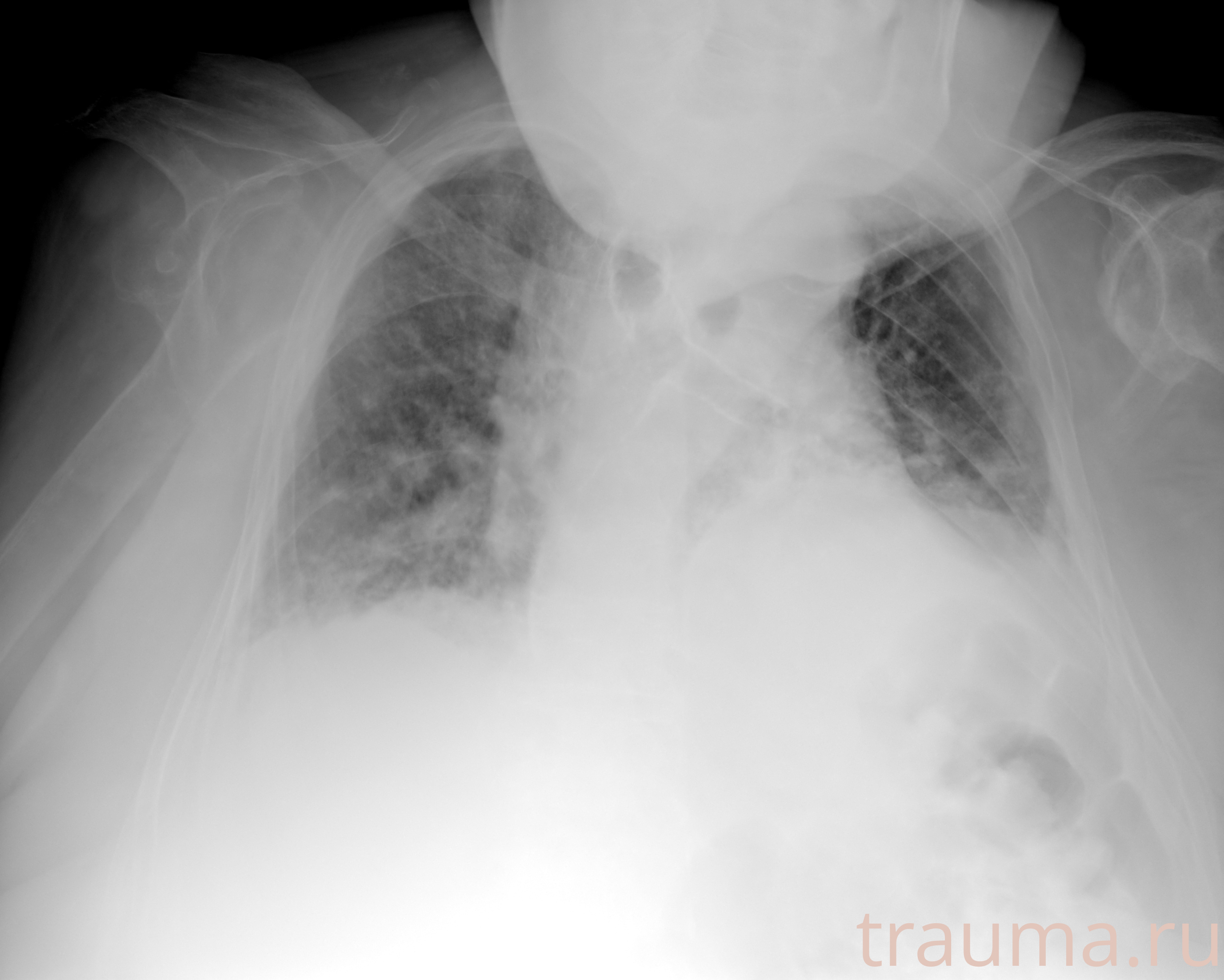 Рентген на дому: по вашему адресу приезжает врач-рентгенолог, травматолог-ортопед с мобильным рентгеновским аппаратом, проводит диагностику травмы или заболевания, делает необходимые рентгенограммы, дает рекомендации по дальнейшему лечению. Получить качественные снимки в домашних условиях возможно благодаря уникальной методике, разработанной МосРентген Центром для института  Склифосовского