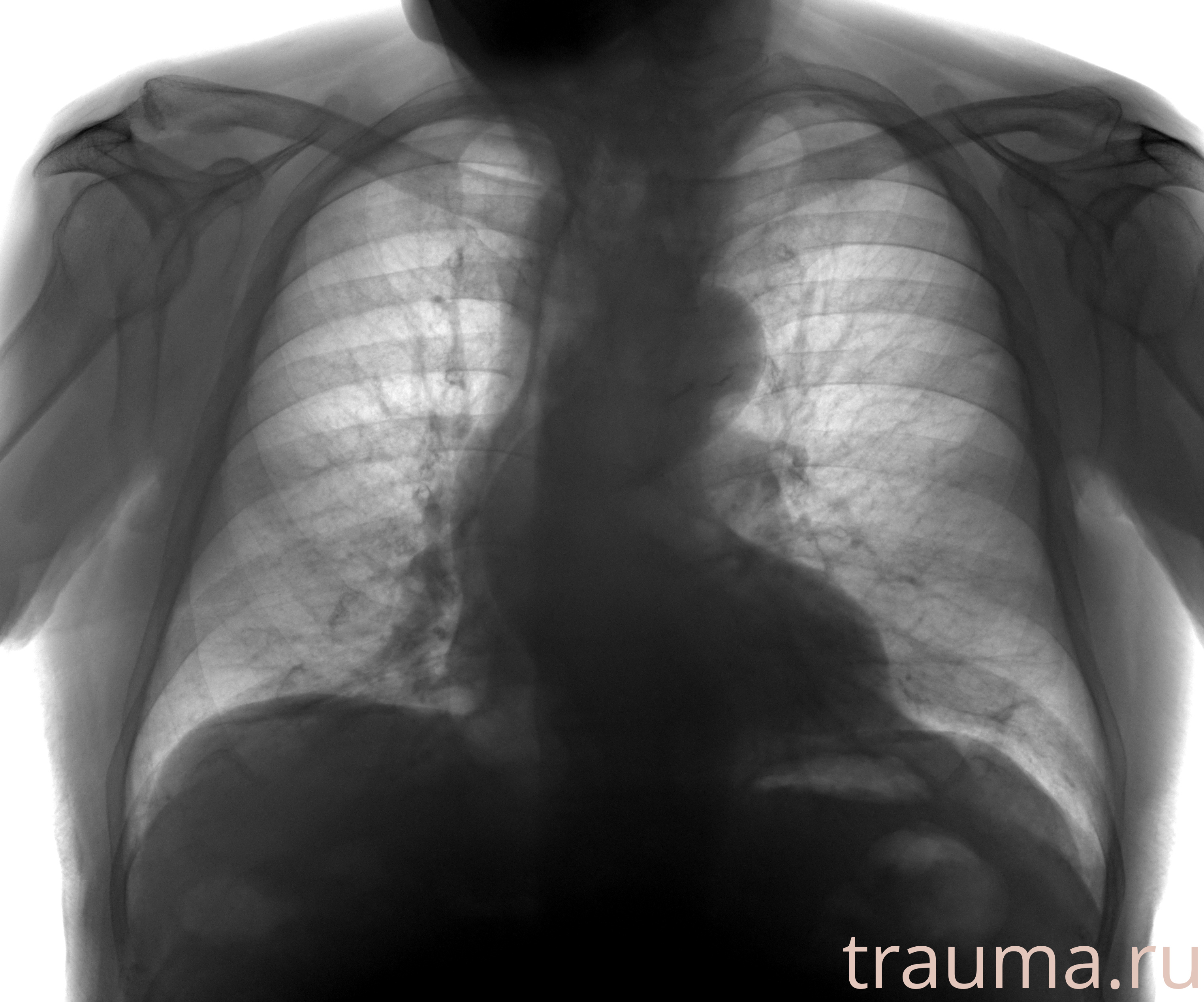Рентген на дому: по вашему адресу приезжает врач-рентгенолог, травматолог-ортопед с мобильным рентгеновским аппаратом, проводит диагностику травмы или заболевания, делает необходимые рентгенограммы, дает рекомендации по дальнейшему лечению. Получить качественные снимки в домашних условиях возможно благодаря уникальной методике, разработанной МосРентген Центром для института  Склифосовского