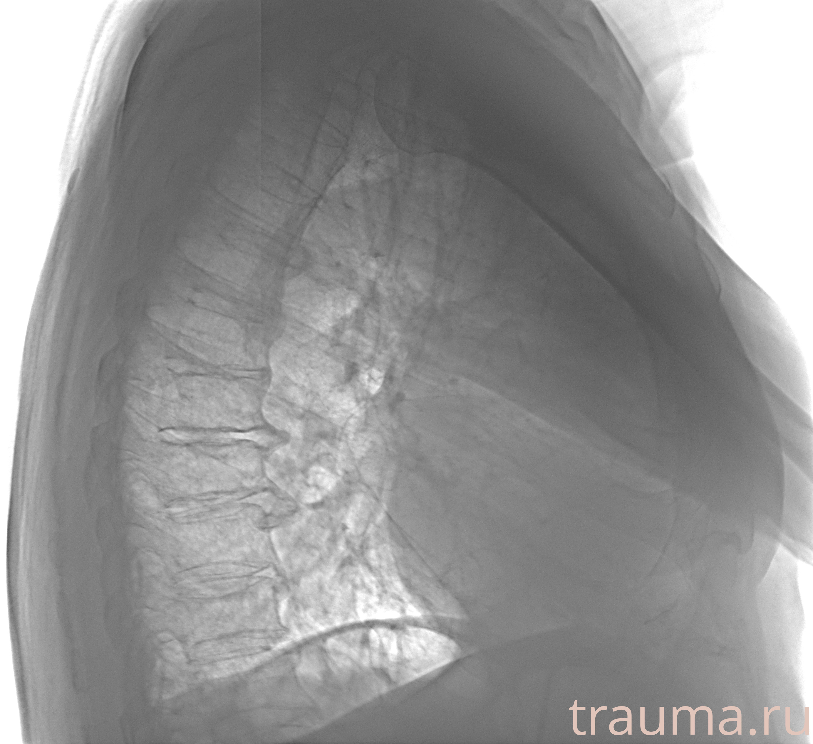 Рентген на дому: по вашему адресу приезжает врач-рентгенолог, травматолог-ортопед с мобильным рентгеновским аппаратом, проводит диагностику травмы или заболевания, делает необходимые рентгенограммы, дает рекомендации по дальнейшему лечению. Получить качественные снимки в домашних условиях возможно благодаря уникальной методике, разработанной МосРентген Центром для института  Склифосовского