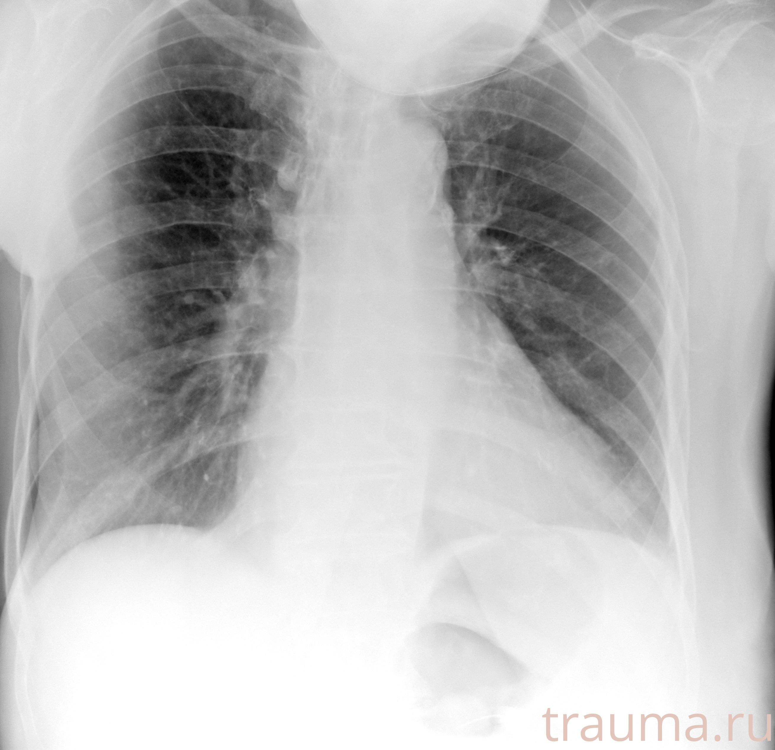 Рентген на дому: по вашему адресу приезжает врач-рентгенолог, травматолог-ортопед с мобильным рентгеновским аппаратом, проводит диагностику травмы или заболевания, делает необходимые рентгенограммы, дает рекомендации по дальнейшему лечению. Получить качественные снимки в домашних условиях возможно благодаря уникальной методике, разработанной МосРентген Центром для института  Склифосовского