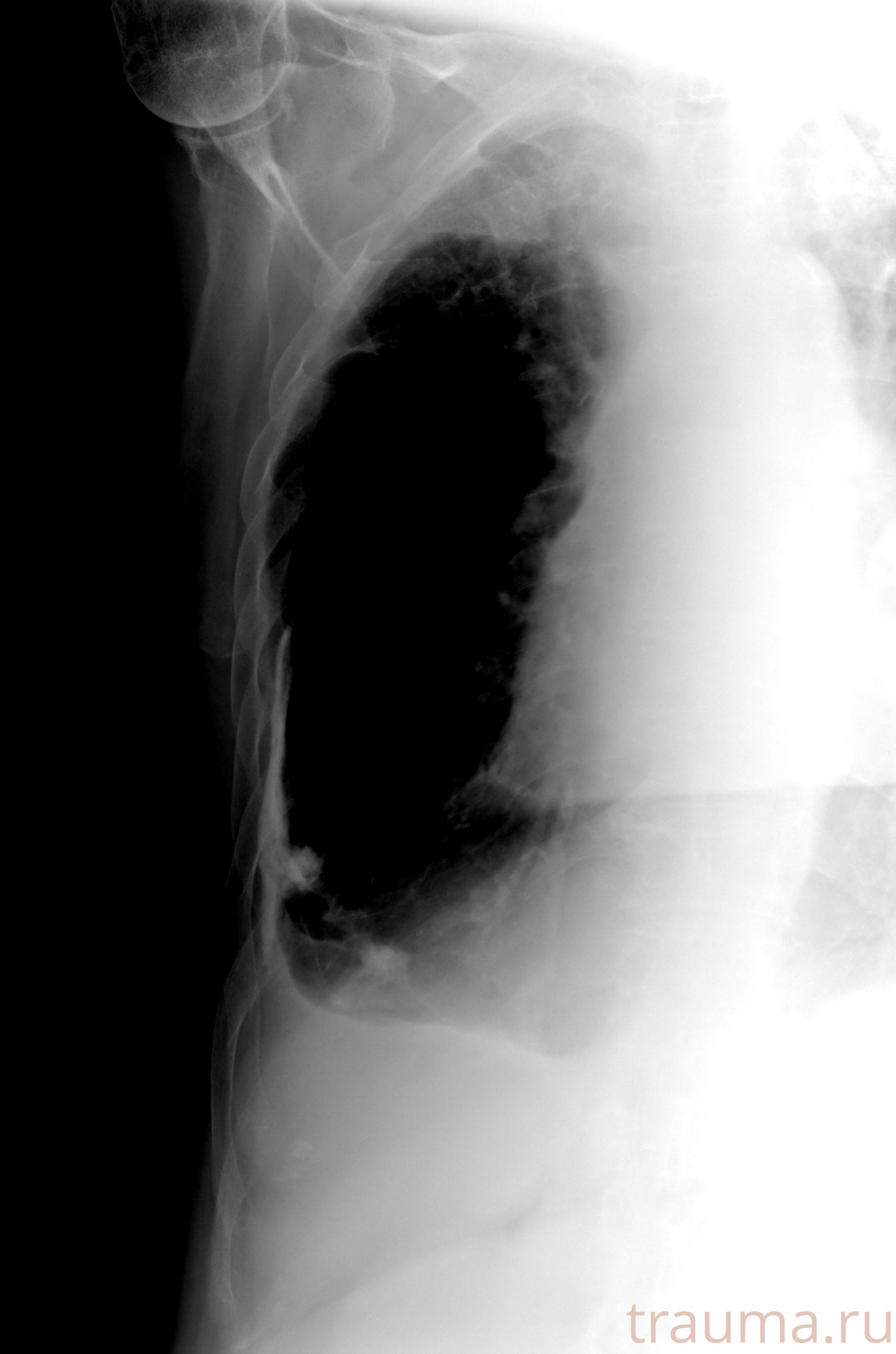 Рентген на дому: по вашему адресу приезжает врач-рентгенолог, травматолог-ортопед с мобильным рентгеновским аппаратом, проводит диагностику травмы или заболевания, делает необходимые рентгенограммы, дает рекомендации по дальнейшему лечению. Получить качественные снимки в домашних условиях возможно благодаря уникальной методике, разработанной МосРентген Центром для института  Склифосовского