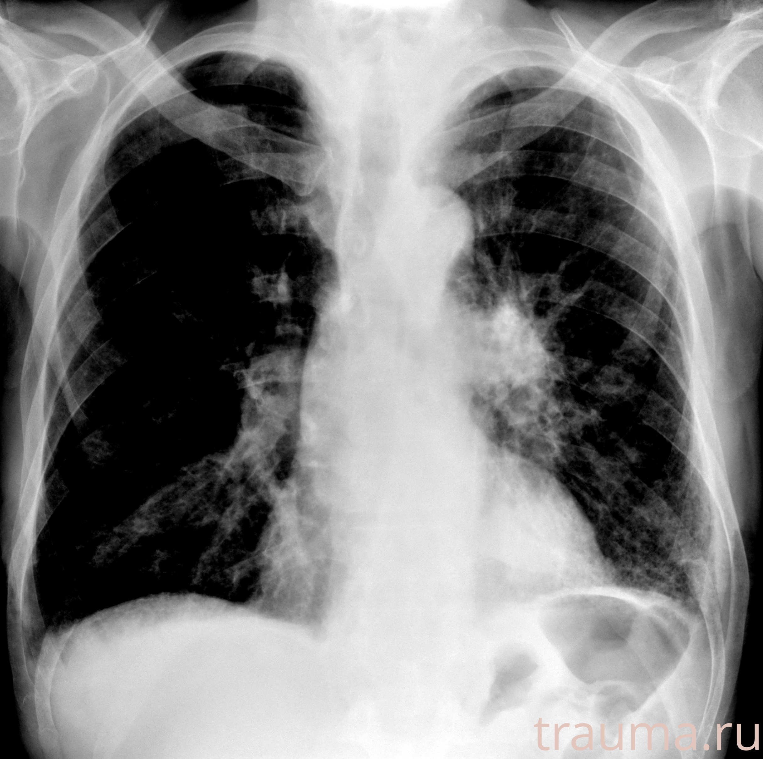 Рентген на дому: по вашему адресу приезжает врач-рентгенолог, травматолог-ортопед с мобильным рентгеновским аппаратом, проводит диагностику травмы или заболевания, делает необходимые рентгенограммы, дает рекомендации по дальнейшему лечению. Получить качественные снимки в домашних условиях возможно благодаря уникальной методике, разработанной МосРентген Центром для института  Склифосовского