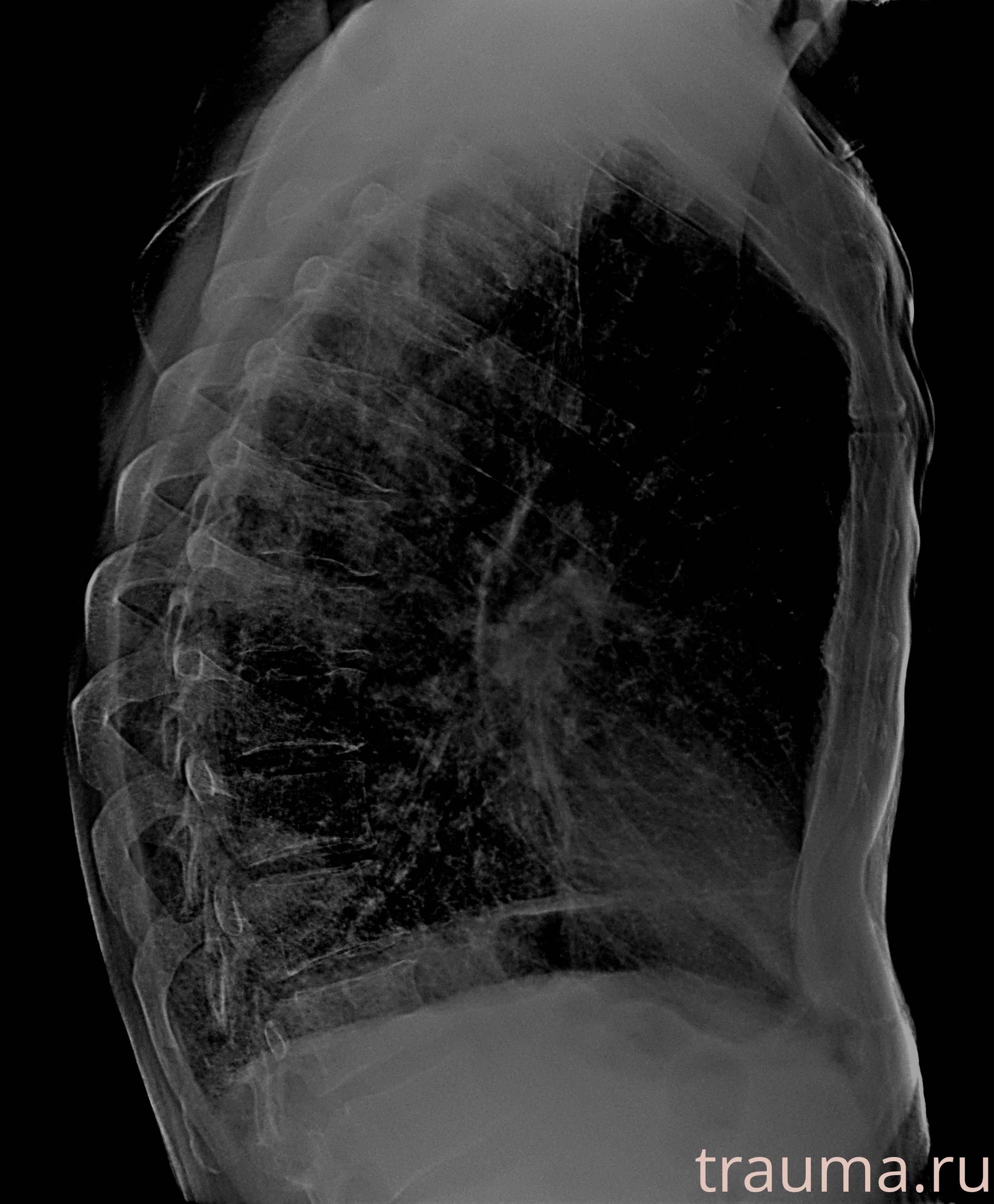 Рентген на дому: по вашему адресу приезжает врач-рентгенолог, травматолог-ортопед с мобильным рентгеновским аппаратом, проводит диагностику травмы или заболевания, делает необходимые рентгенограммы, дает рекомендации по дальнейшему лечению. Получить качественные снимки в домашних условиях возможно благодаря уникальной методике, разработанной МосРентген Центром для института  Склифосовского