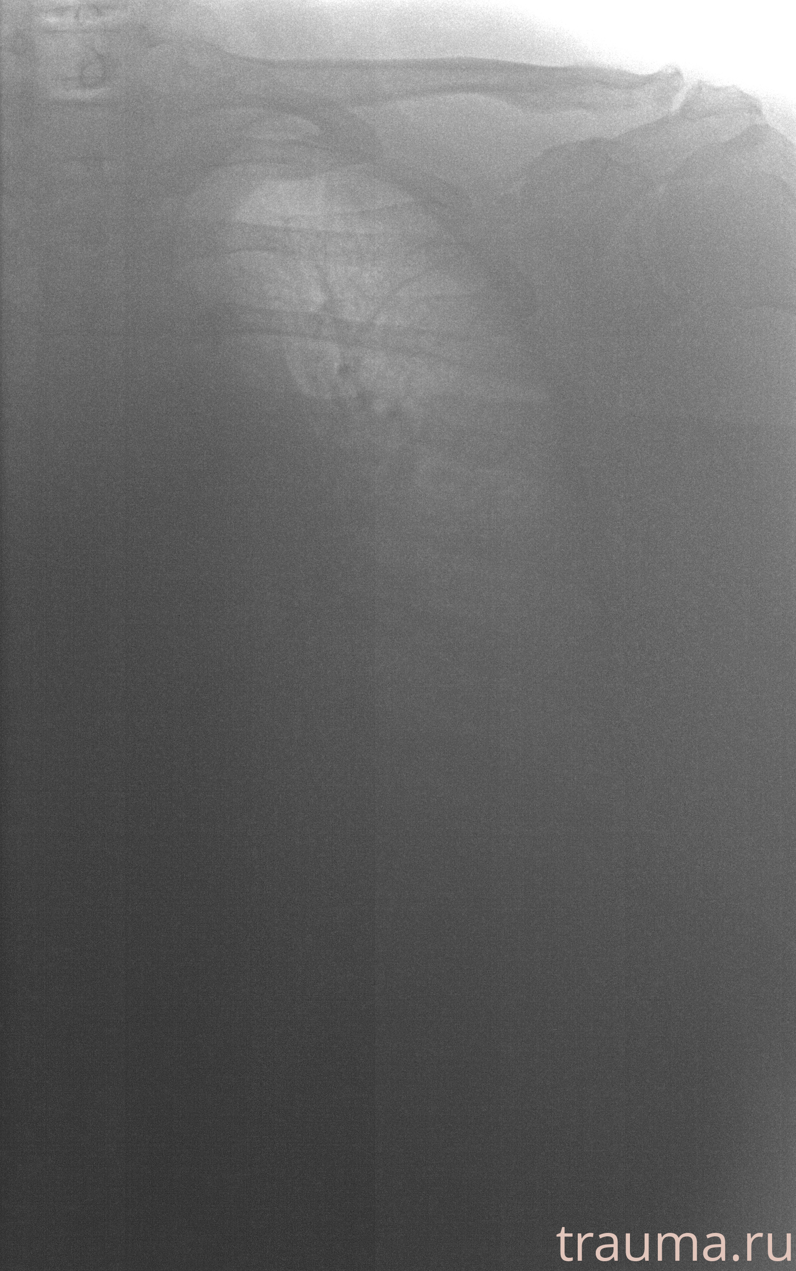 Рентген на дому: по вашему адресу приезжает врач-рентгенолог, травматолог-ортопед с мобильным рентгеновским аппаратом, проводит диагностику травмы или заболевания, делает необходимые рентгенограммы, дает рекомендации по дальнейшему лечению. Получить качественные снимки в домашних условиях возможно благодаря уникальной методике, разработанной МосРентген Центром для института  Склифосовского