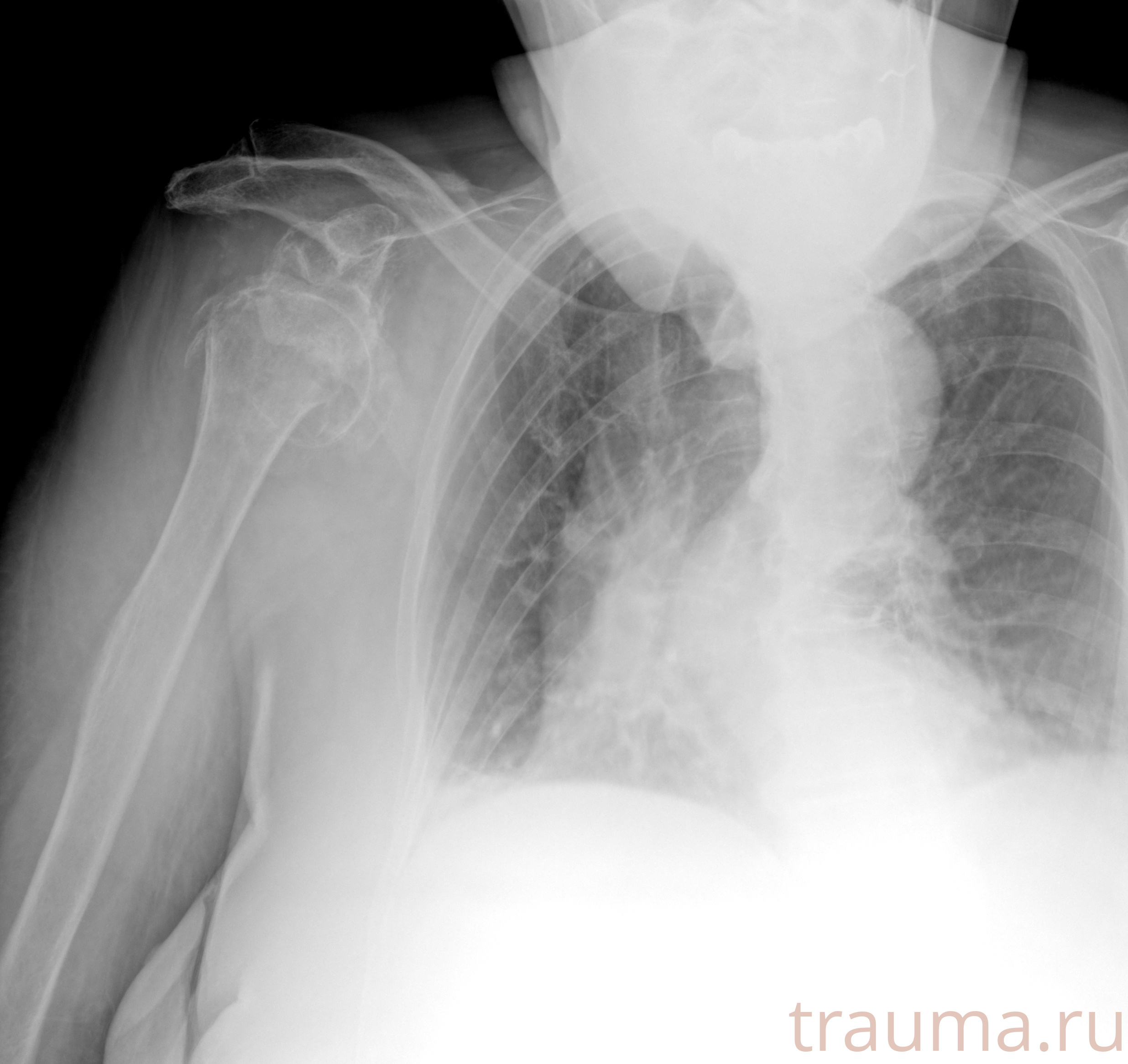 Рентген на дому: по вашему адресу приезжает врач-рентгенолог, травматолог-ортопед с мобильным рентгеновским аппаратом, проводит диагностику травмы или заболевания, делает необходимые рентгенограммы, дает рекомендации по дальнейшему лечению. Получить качественные снимки в домашних условиях возможно благодаря уникальной методике, разработанной МосРентген Центром для института  Склифосовского