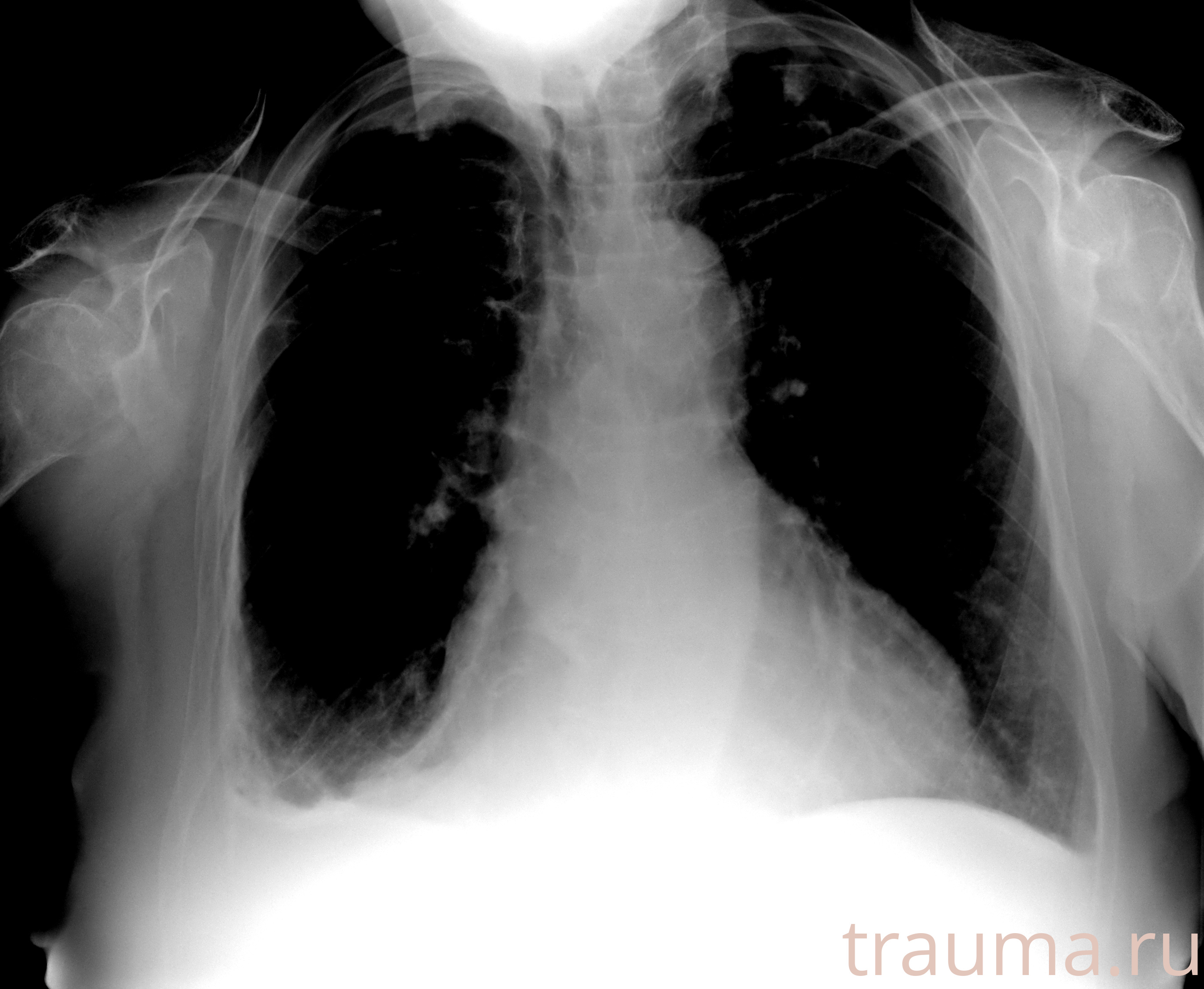 Рентген на дому: по вашему адресу приезжает врач-рентгенолог, травматолог-ортопед с мобильным рентгеновским аппаратом, проводит диагностику травмы или заболевания, делает необходимые рентгенограммы, дает рекомендации по дальнейшему лечению. Получить качественные снимки в домашних условиях возможно благодаря уникальной методике, разработанной МосРентген Центром для института  Склифосовского