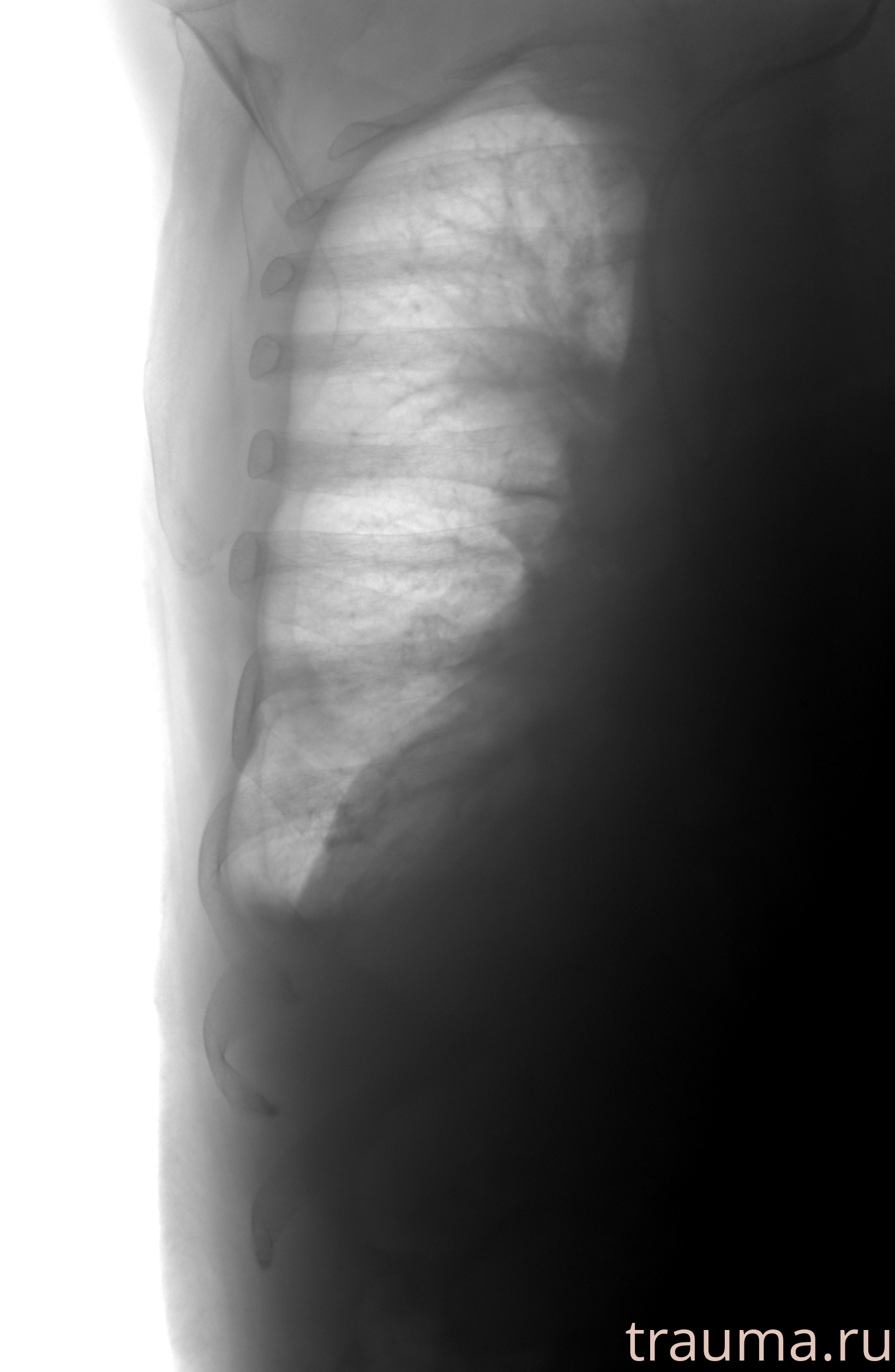 Рентген на дому: по вашему адресу приезжает врач-рентгенолог, травматолог-ортопед с мобильным рентгеновским аппаратом, проводит диагностику травмы или заболевания, делает необходимые рентгенограммы, дает рекомендации по дальнейшему лечению. Получить качественные снимки в домашних условиях возможно благодаря уникальной методике, разработанной МосРентген Центром для института  Склифосовского