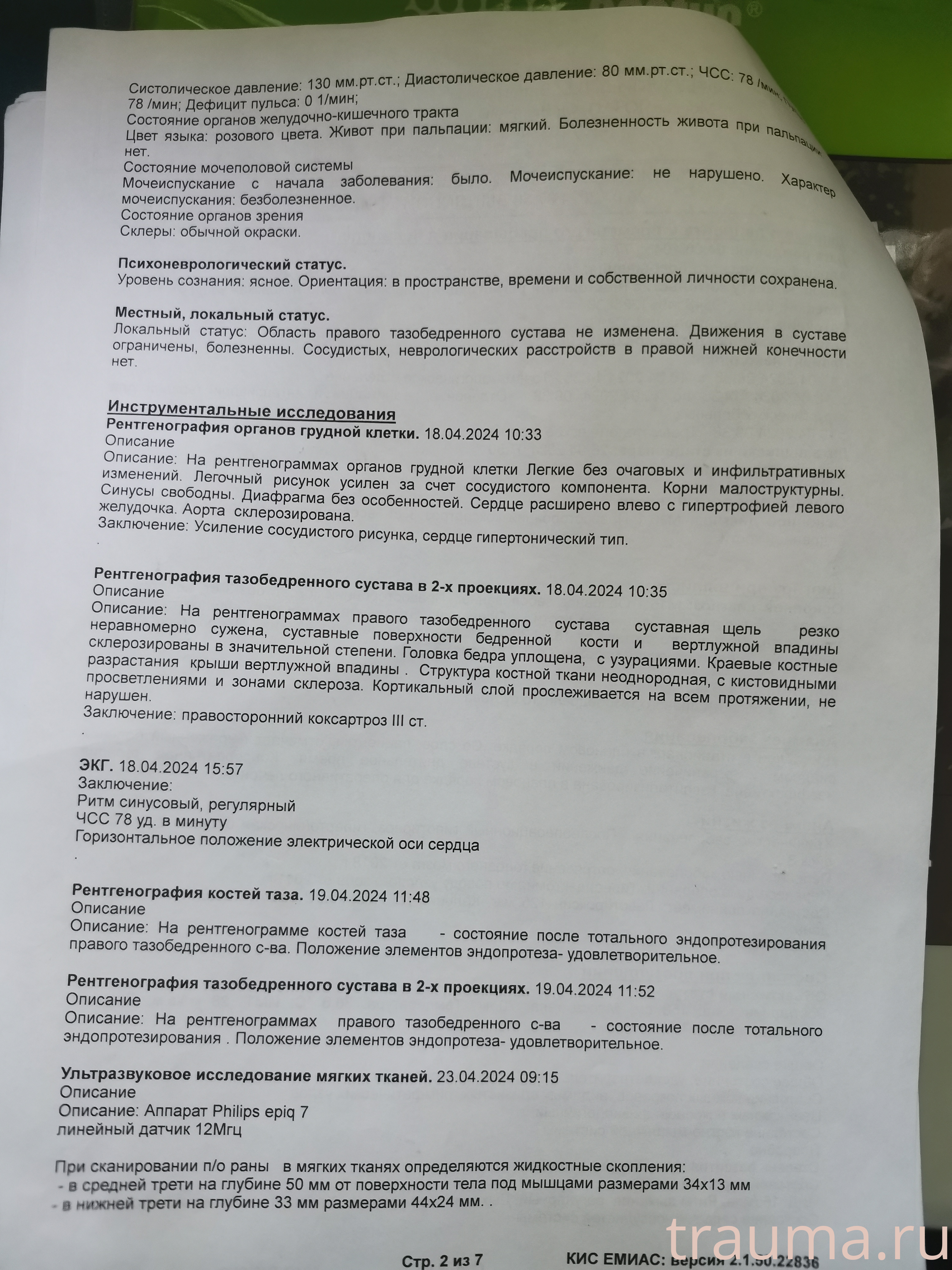 Рентген на дому: по вашему адресу приезжает врач-рентгенолог, травматолог-ортопед с мобильным рентгеновским аппаратом, проводит диагностику травмы или заболевания, делает необходимые рентгенограммы, дает рекомендации по дальнейшему лечению. Получить качественные снимки в домашних условиях возможно благодаря уникальной методике, разработанной МосРентген Центром для института  Склифосовского