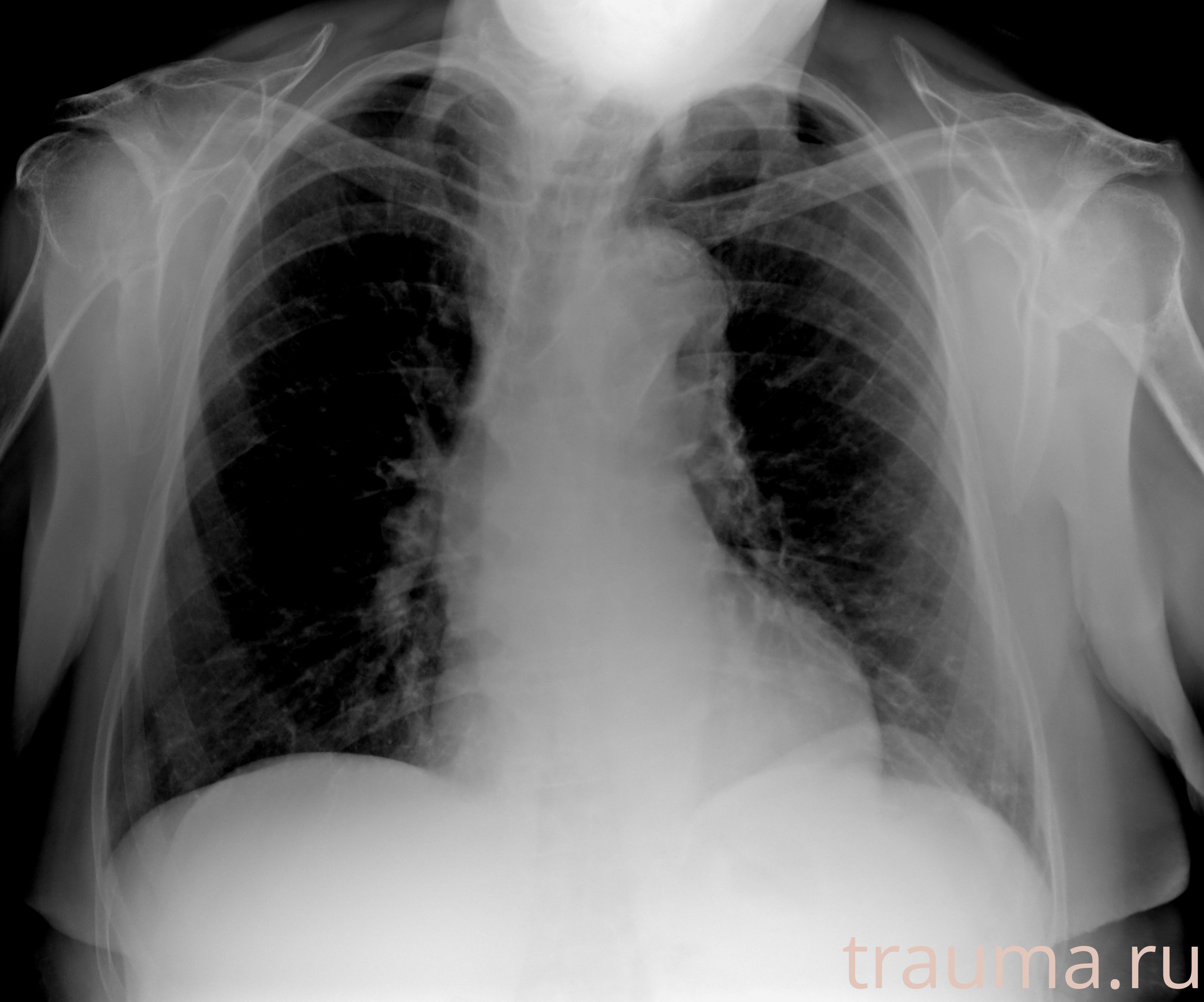 Рентген на дому: по вашему адресу приезжает врач-рентгенолог, травматолог-ортопед с мобильным рентгеновским аппаратом, проводит диагностику травмы или заболевания, делает необходимые рентгенограммы, дает рекомендации по дальнейшему лечению. Получить качественные снимки в домашних условиях возможно благодаря уникальной методике, разработанной МосРентген Центром для института  Склифосовского