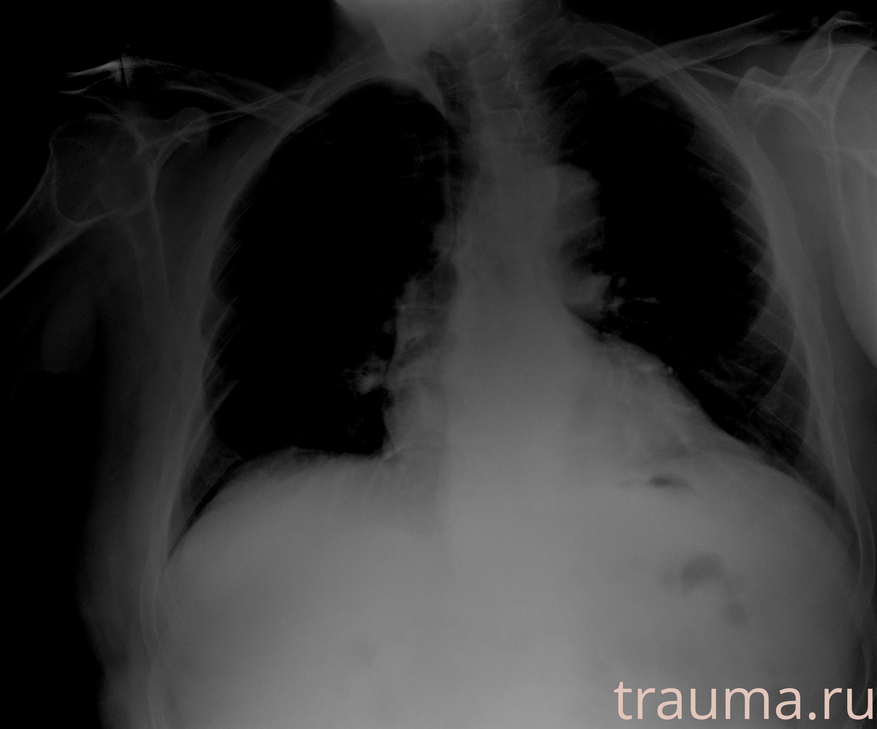 Рентген на дому: по вашему адресу приезжает врач-рентгенолог, травматолог-ортопед с мобильным рентгеновским аппаратом, проводит диагностику травмы или заболевания, делает необходимые рентгенограммы, дает рекомендации по дальнейшему лечению. Получить качественные снимки в домашних условиях возможно благодаря уникальной методике, разработанной МосРентген Центром для института  Склифосовского