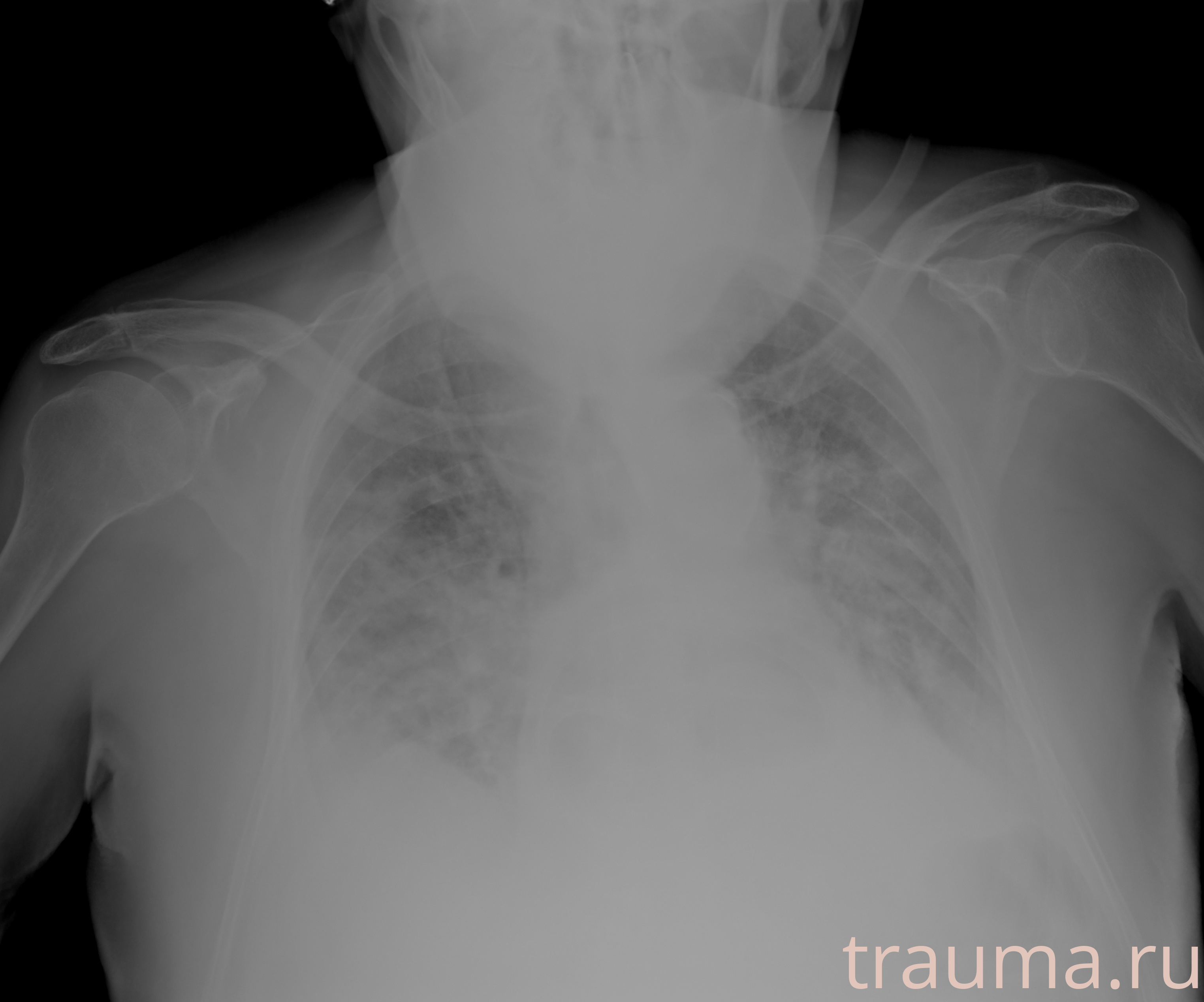 Рентген на дому: по вашему адресу приезжает врач-рентгенолог, травматолог-ортопед с мобильным рентгеновским аппаратом, проводит диагностику травмы или заболевания, делает необходимые рентгенограммы, дает рекомендации по дальнейшему лечению. Получить качественные снимки в домашних условиях возможно благодаря уникальной методике, разработанной МосРентген Центром для института  Склифосовского