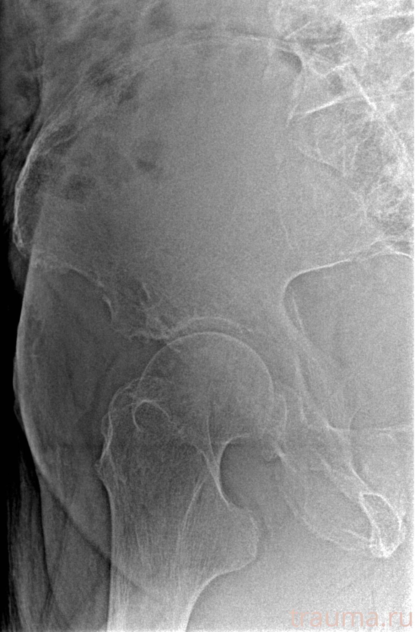 Рентген на дому: по вашему адресу приезжает врач-рентгенолог, травматолог-ортопед с мобильным рентгеновским аппаратом, проводит диагностику травмы или заболевания, делает необходимые рентгенограммы, дает рекомендации по дальнейшему лечению. Получить качественные снимки в домашних условиях возможно благодаря уникальной методике, разработанной МосРентген Центром для института  Склифосовского
