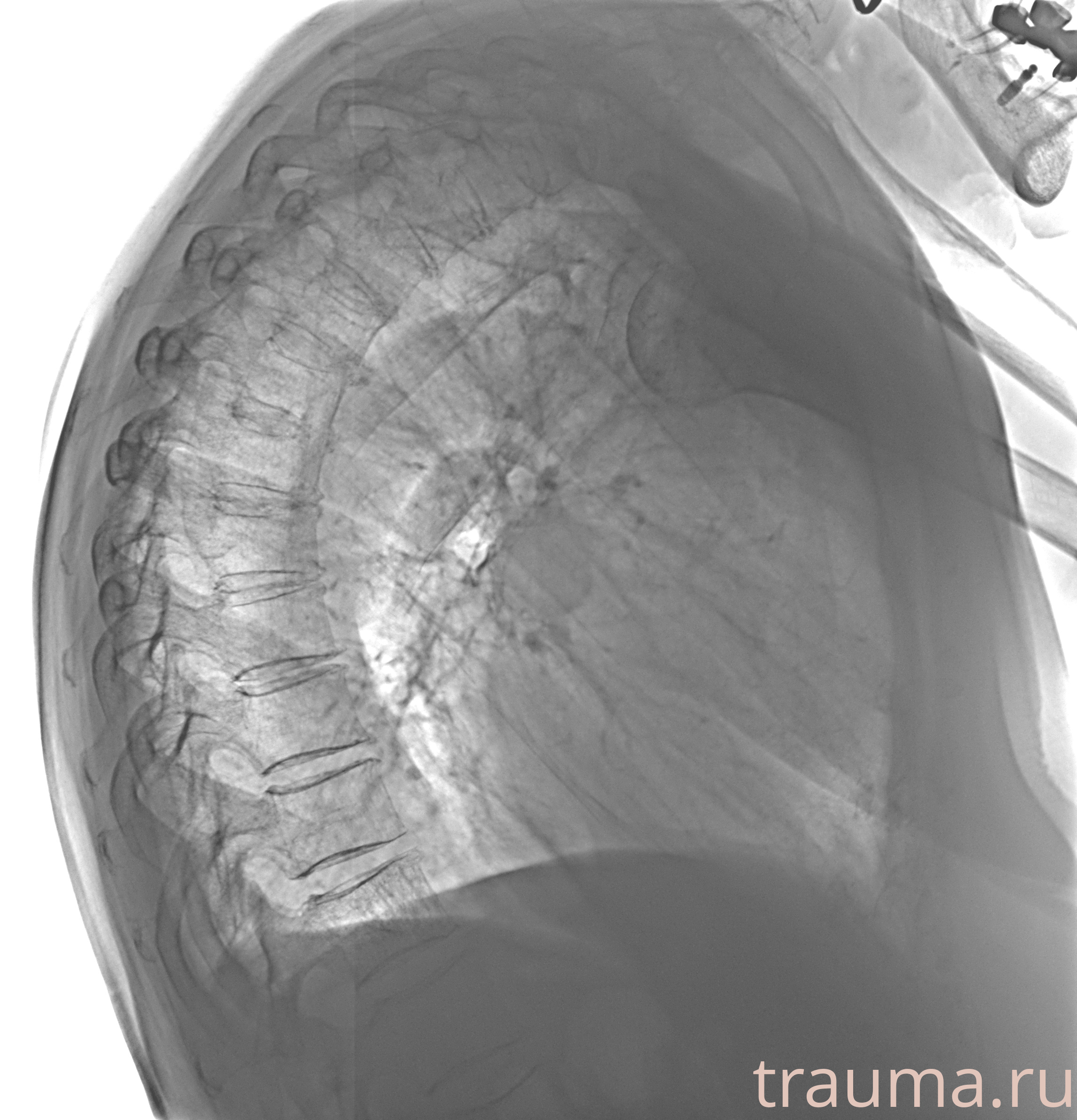 Рентген на дому: по вашему адресу приезжает врач-рентгенолог, травматолог-ортопед с мобильным рентгеновским аппаратом, проводит диагностику травмы или заболевания, делает необходимые рентгенограммы, дает рекомендации по дальнейшему лечению. Получить качественные снимки в домашних условиях возможно благодаря уникальной методике, разработанной МосРентген Центром для института  Склифосовского