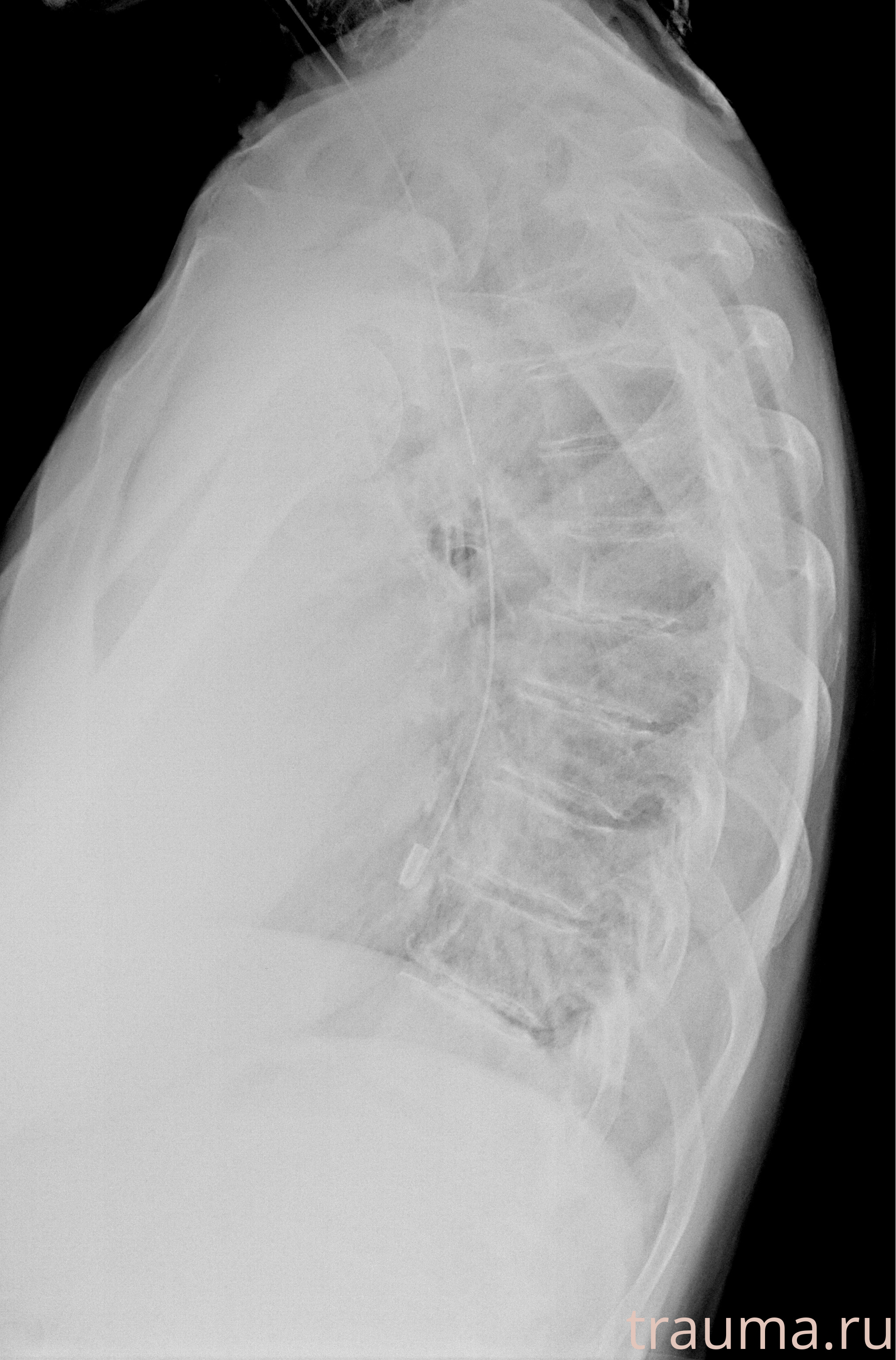 Рентген на дому: по вашему адресу приезжает врач-рентгенолог, травматолог-ортопед с мобильным рентгеновским аппаратом, проводит диагностику травмы или заболевания, делает необходимые рентгенограммы, дает рекомендации по дальнейшему лечению. Получить качественные снимки в домашних условиях возможно благодаря уникальной методике, разработанной МосРентген Центром для института  Склифосовского
