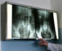 Функция дисплейного затвора в рентгенографии Функция дисплейного затвора в рентгенографии