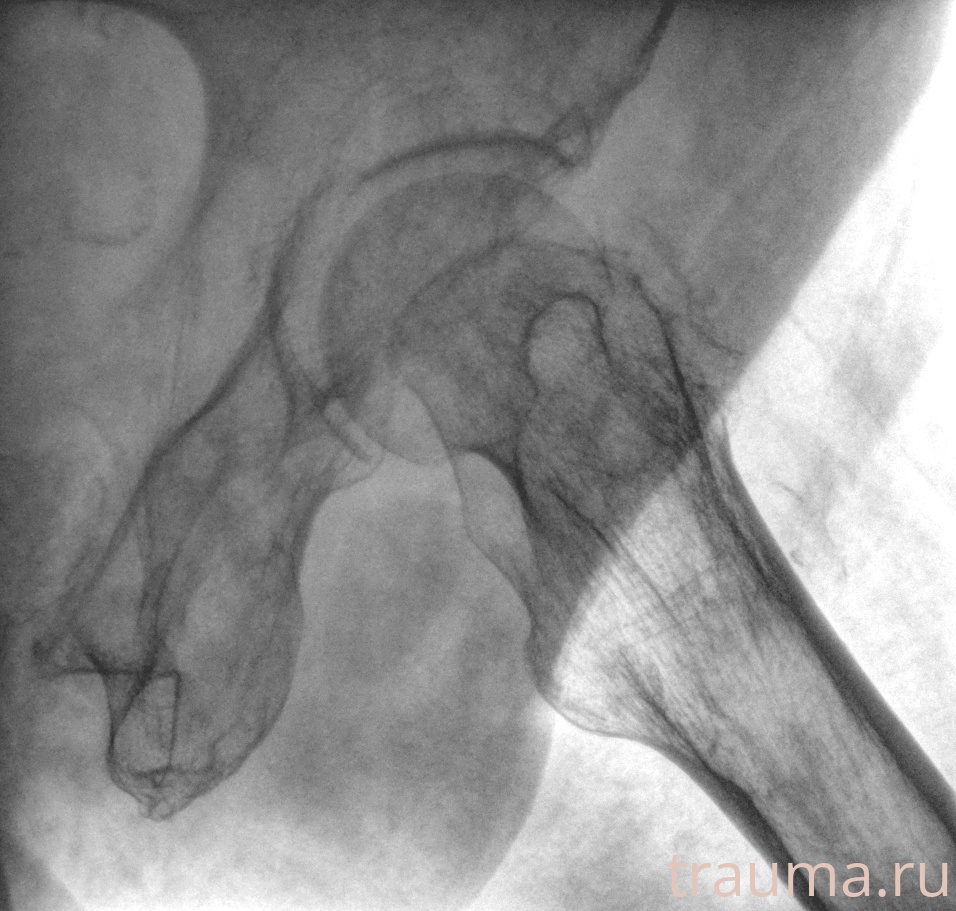 Рентген на дому: по вашему адресу приезжает врач-рентгенолог, травматолог-ортопед с мобильным рентгеновским аппаратом, проводит диагностику травмы или заболевания, делает необходимые рентгенограммы, дает рекомендации по дальнейшему лечению. Получить качественные снимки в домашних условиях возможно благодаря уникальной методике, разработанной МосРентген Центром для института  Склифосовского