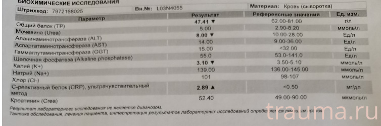 Рентген на дому: по вашему адресу приезжает врач-рентгенолог, травматолог-ортопед с мобильным рентгеновским аппаратом, проводит диагностику травмы или заболевания, делает необходимые рентгенограммы, дает рекомендации по дальнейшему лечению. Получить качественные снимки в домашних условиях возможно благодаря уникальной методике, разработанной МосРентген Центром для института  Склифосовского