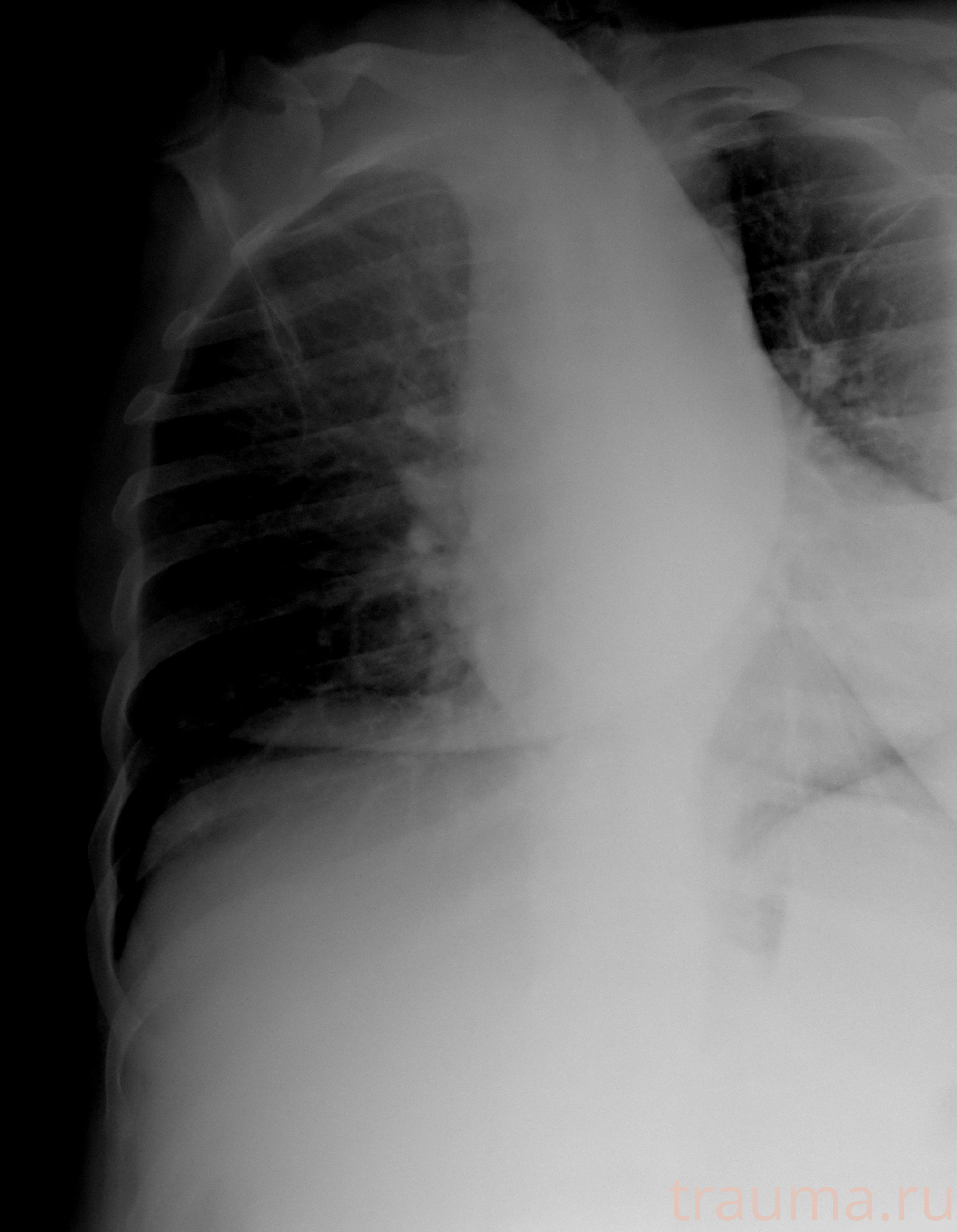 Рентген на дому: по вашему адресу приезжает врач-рентгенолог, травматолог-ортопед с мобильным рентгеновским аппаратом, проводит диагностику травмы или заболевания, делает необходимые рентгенограммы, дает рекомендации по дальнейшему лечению. Получить качественные снимки в домашних условиях возможно благодаря уникальной методике, разработанной МосРентген Центром для института  Склифосовского