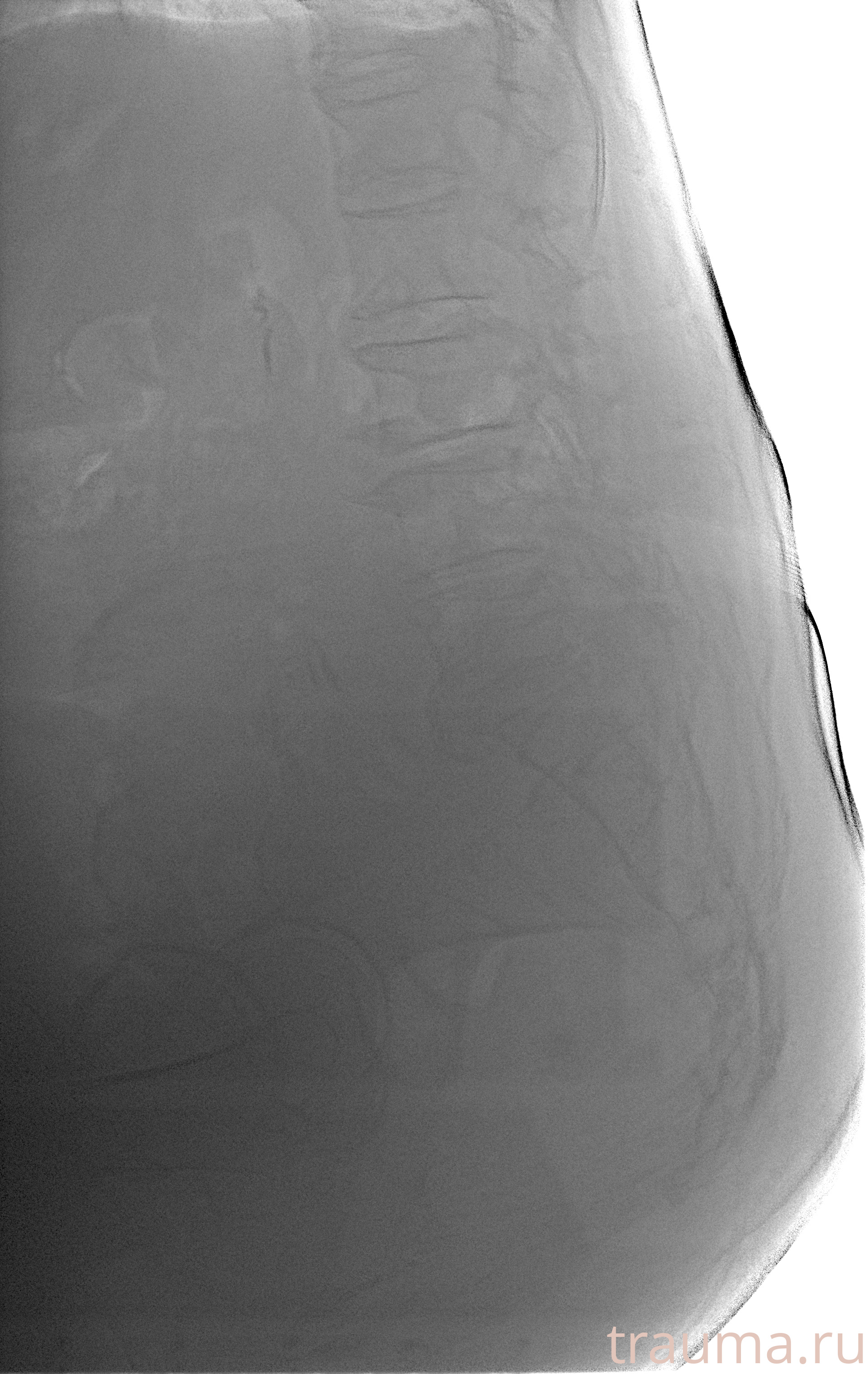 Рентген на дому: по вашему адресу приезжает врач-рентгенолог, травматолог-ортопед с мобильным рентгеновским аппаратом, проводит диагностику травмы или заболевания, делает необходимые рентгенограммы, дает рекомендации по дальнейшему лечению. Получить качественные снимки в домашних условиях возможно благодаря уникальной методике, разработанной МосРентген Центром для института  Склифосовского