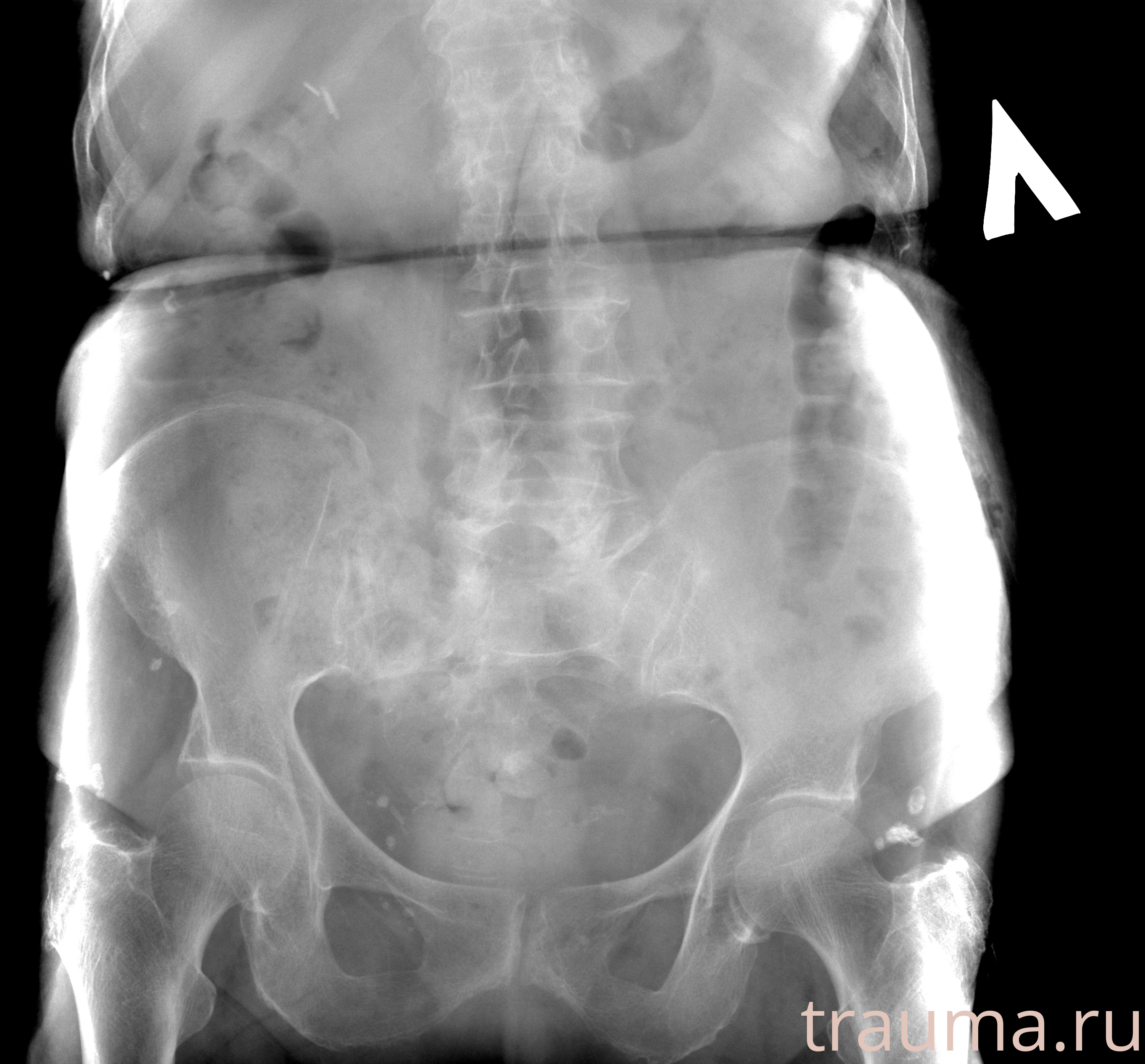 Рентген на дому: по вашему адресу приезжает врач-рентгенолог, травматолог-ортопед с мобильным рентгеновским аппаратом, проводит диагностику травмы или заболевания, делает необходимые рентгенограммы, дает рекомендации по дальнейшему лечению. Получить качественные снимки в домашних условиях возможно благодаря уникальной методике, разработанной МосРентген Центром для института  Склифосовского