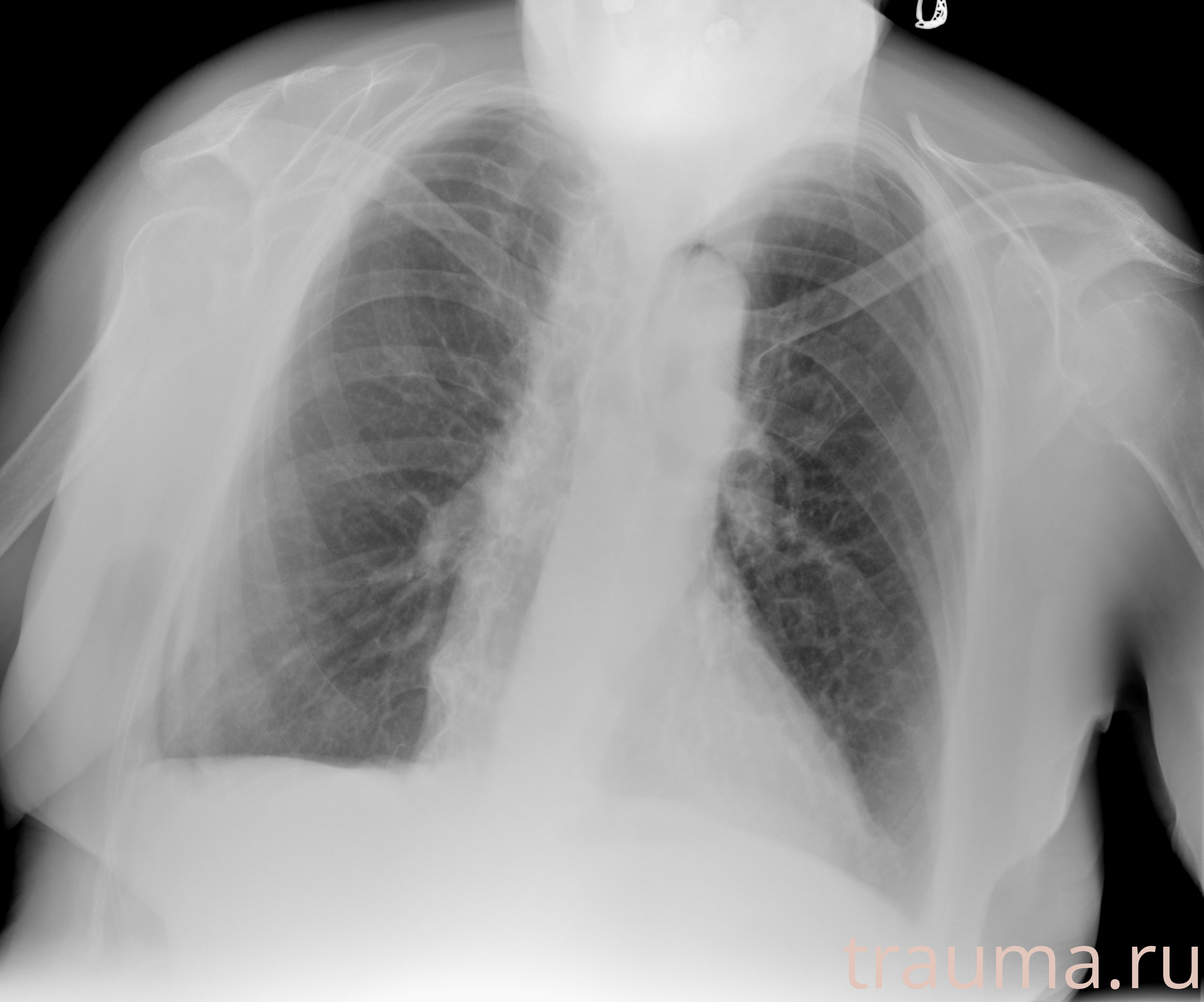 Рентген на дому: по вашему адресу приезжает врач-рентгенолог, травматолог-ортопед с мобильным рентгеновским аппаратом, проводит диагностику травмы или заболевания, делает необходимые рентгенограммы, дает рекомендации по дальнейшему лечению. Получить качественные снимки в домашних условиях возможно благодаря уникальной методике, разработанной МосРентген Центром для института  Склифосовского