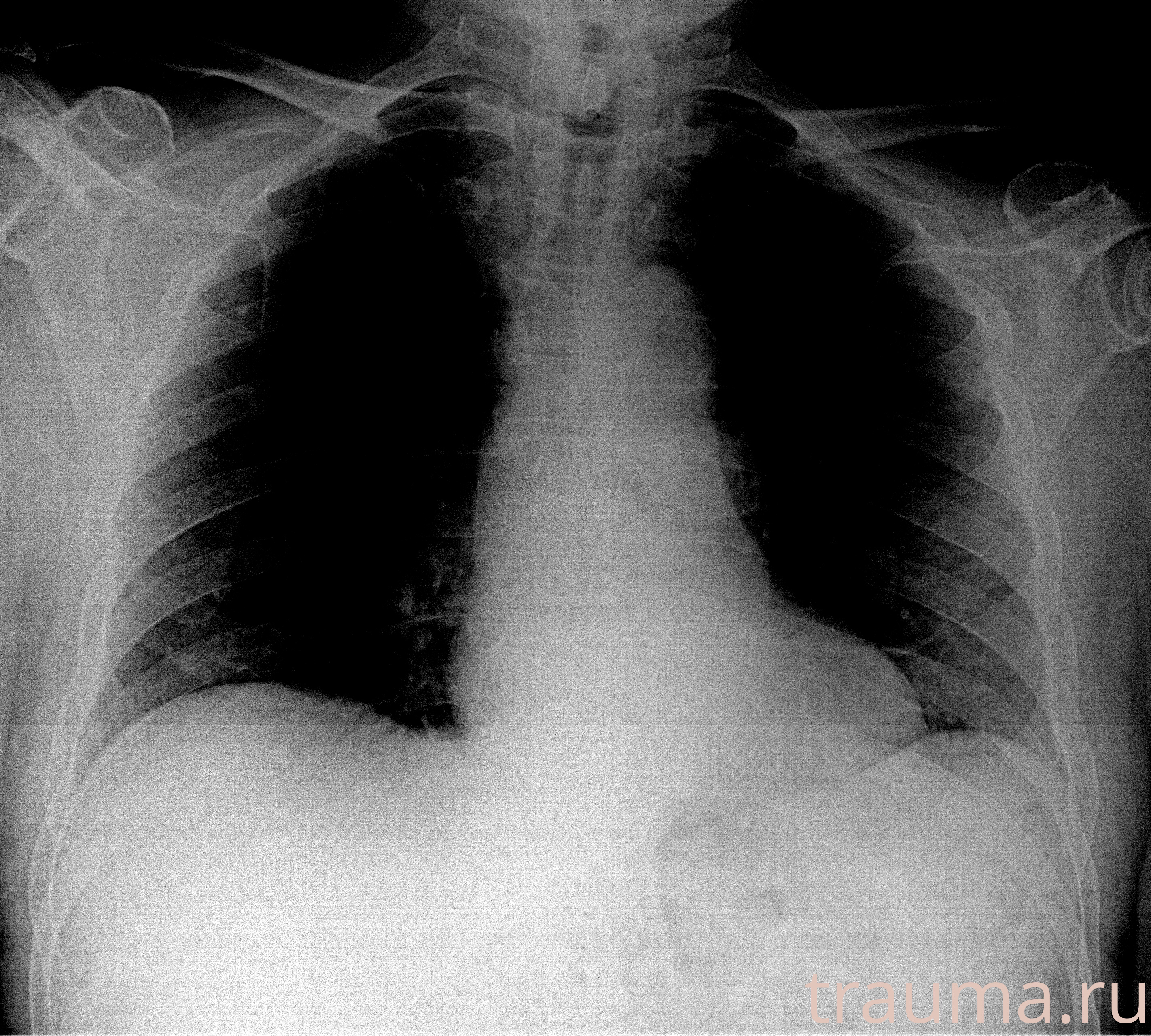 Рентген на дому: по вашему адресу приезжает врач-рентгенолог, травматолог-ортопед с мобильным рентгеновским аппаратом, проводит диагностику травмы или заболевания, делает необходимые рентгенограммы, дает рекомендации по дальнейшему лечению. Получить качественные снимки в домашних условиях возможно благодаря уникальной методике, разработанной МосРентген Центром для института  Склифосовского