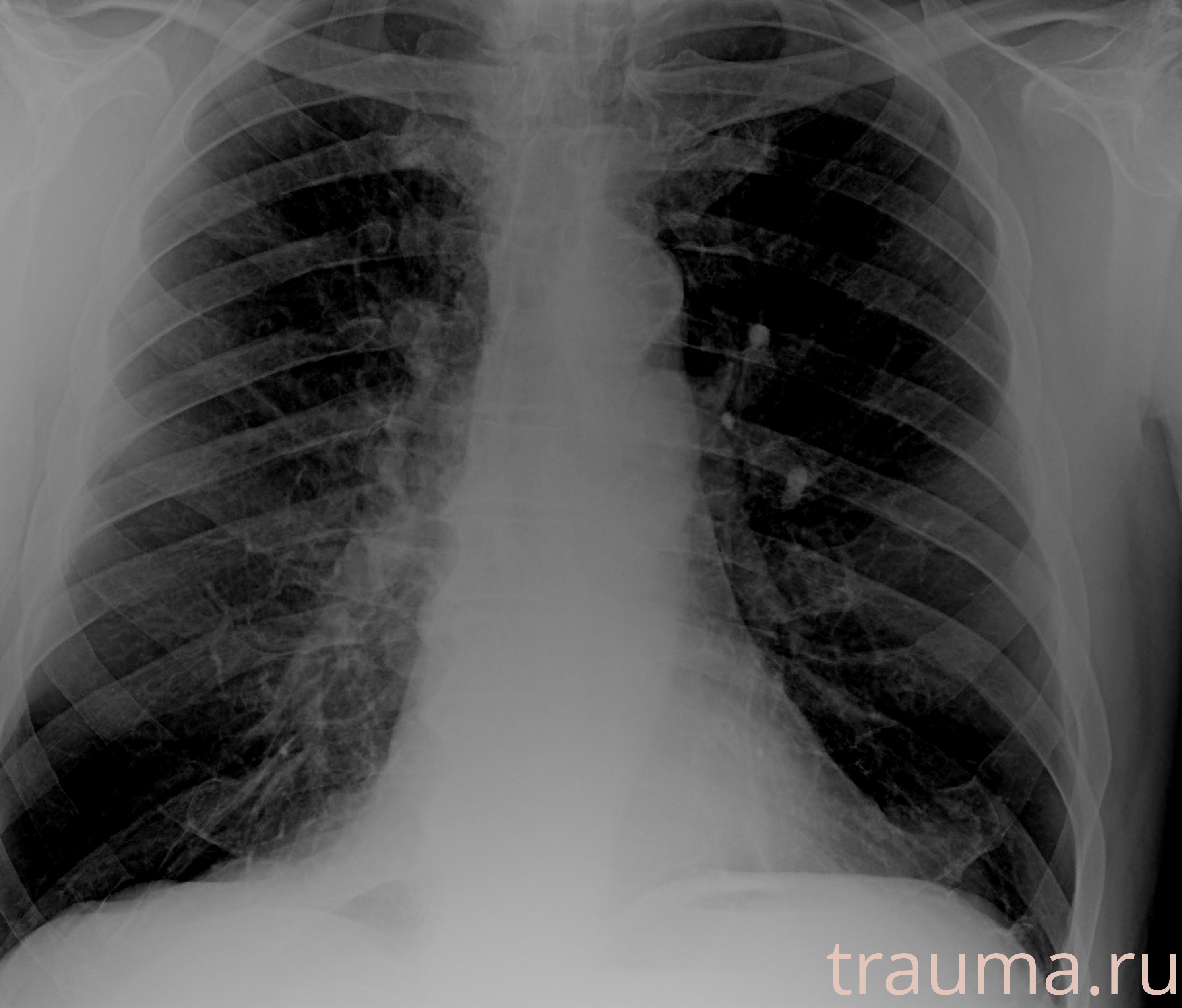 Рентген на дому: по вашему адресу приезжает врач-рентгенолог, травматолог-ортопед с мобильным рентгеновским аппаратом, проводит диагностику травмы или заболевания, делает необходимые рентгенограммы, дает рекомендации по дальнейшему лечению. Получить качественные снимки в домашних условиях возможно благодаря уникальной методике, разработанной МосРентген Центром для института  Склифосовского