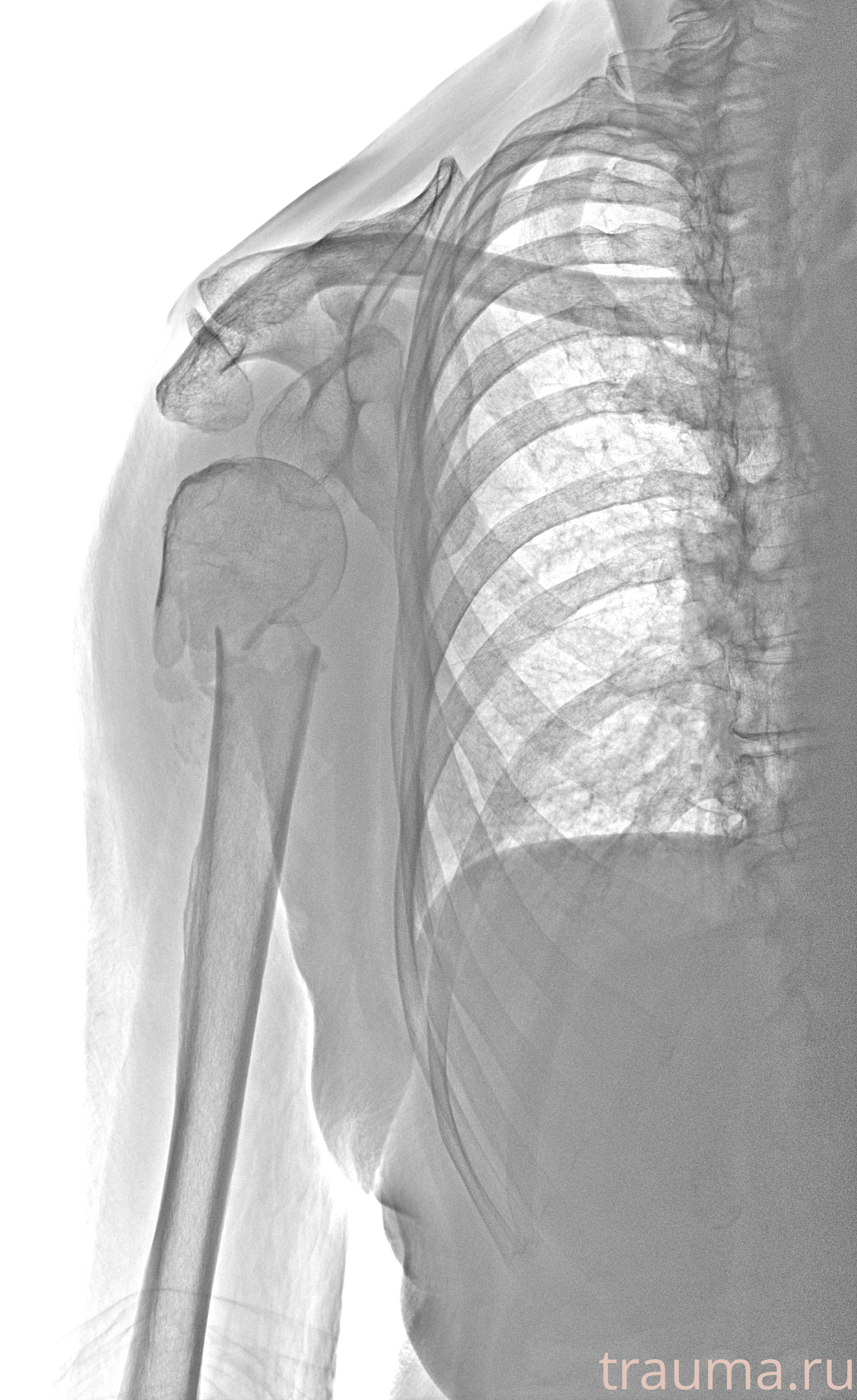 Рентген на дому: по вашему адресу приезжает врач-рентгенолог, травматолог-ортопед с мобильным рентгеновским аппаратом, проводит диагностику травмы или заболевания, делает необходимые рентгенограммы, дает рекомендации по дальнейшему лечению. Получить качественные снимки в домашних условиях возможно благодаря уникальной методике, разработанной МосРентген Центром для института  Склифосовского