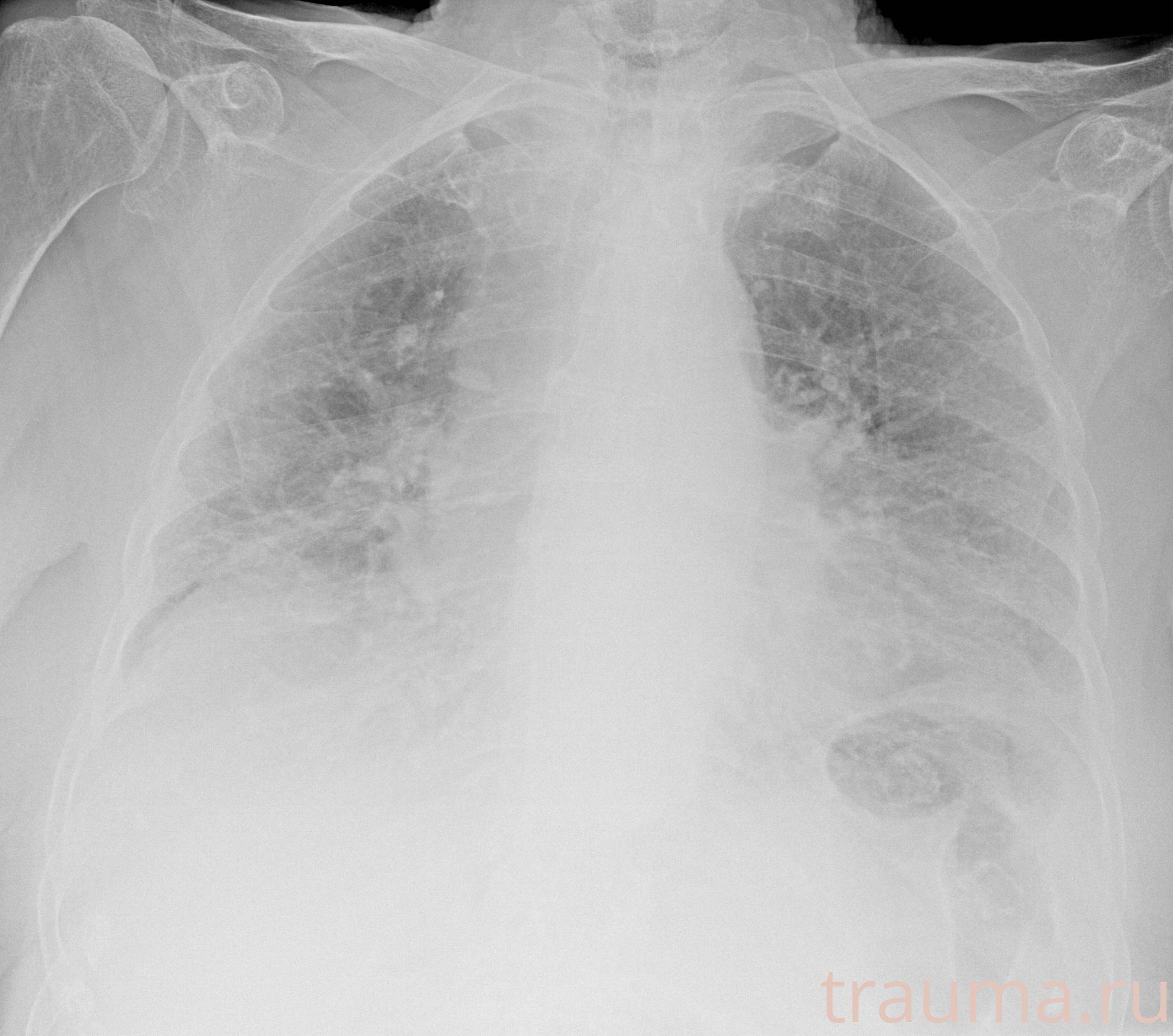 Рентген на дому: по вашему адресу приезжает врач-рентгенолог, травматолог-ортопед с мобильным рентгеновским аппаратом, проводит диагностику травмы или заболевания, делает необходимые рентгенограммы, дает рекомендации по дальнейшему лечению. Получить качественные снимки в домашних условиях возможно благодаря уникальной методике, разработанной МосРентген Центром для института  Склифосовского