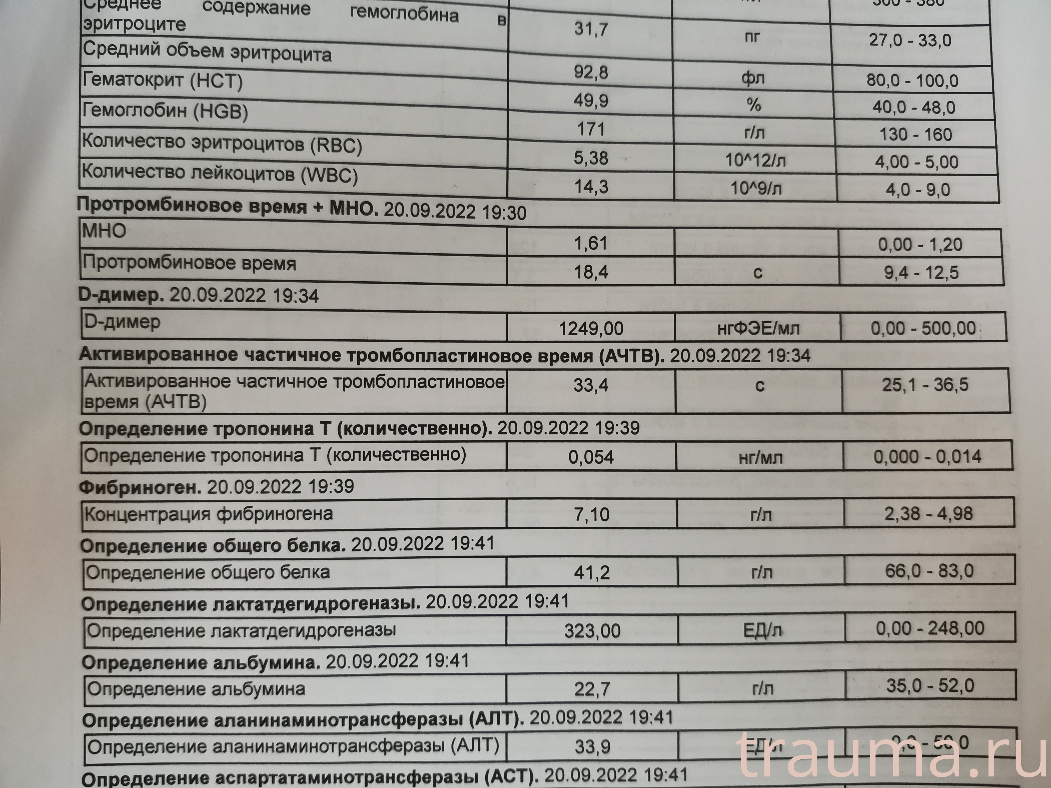 Рентген на дому: по вашему адресу приезжает врач-рентгенолог, травматолог-ортопед с мобильным рентгеновским аппаратом, проводит диагностику травмы или заболевания, делает необходимые рентгенограммы, дает рекомендации по дальнейшему лечению. Получить качественные снимки в домашних условиях возможно благодаря уникальной методике, разработанной МосРентген Центром для института  Склифосовского