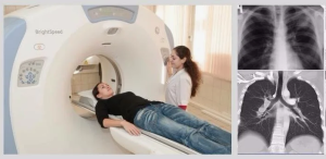 Возможности и место мультиспиральной компьютерной томографии в диагностике травмы органов грудной клетки

