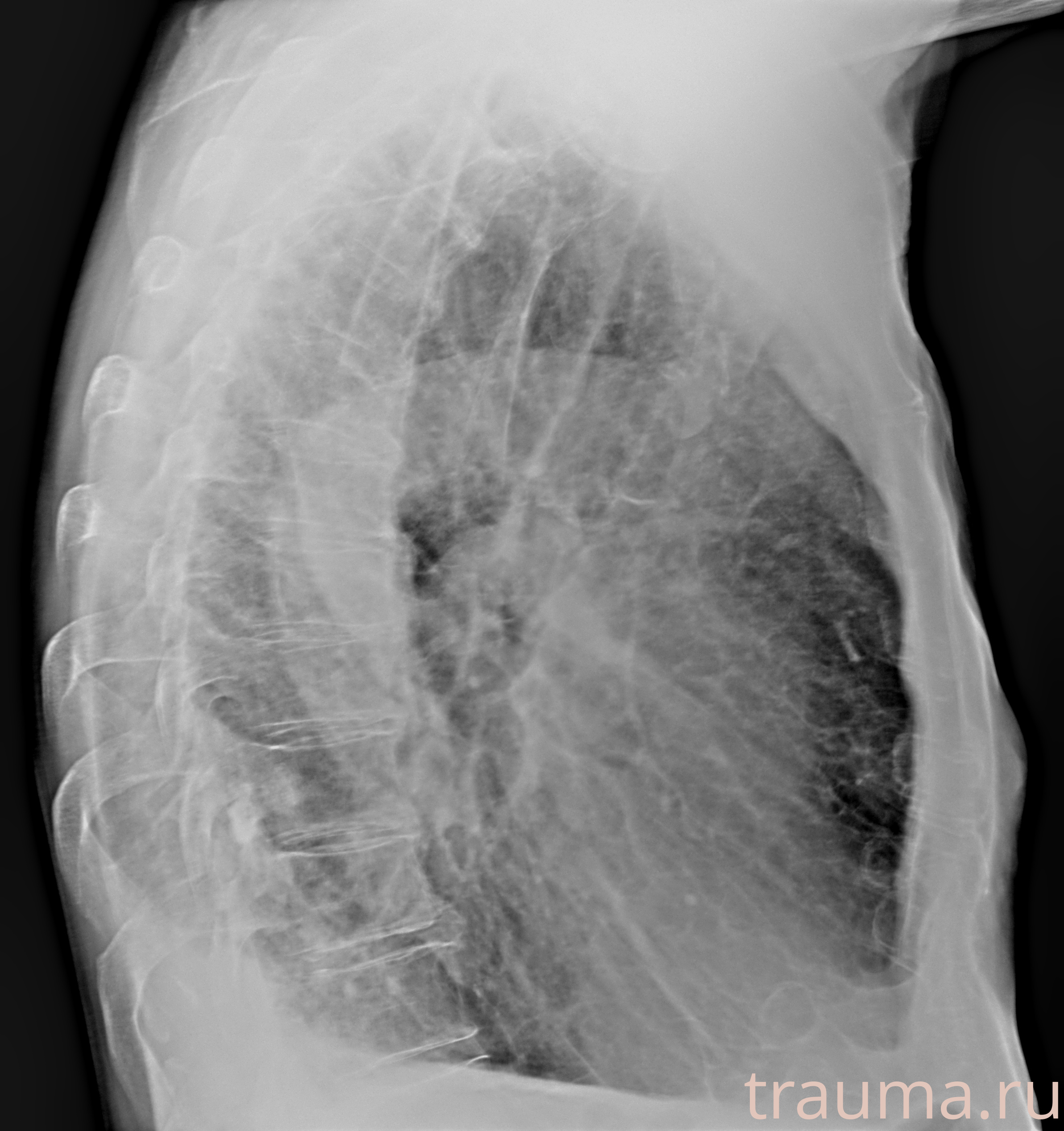 Рентген на дому: по вашему адресу приезжает врач-рентгенолог, травматолог-ортопед с мобильным рентгеновским аппаратом, проводит диагностику травмы или заболевания, делает необходимые рентгенограммы, дает рекомендации по дальнейшему лечению. Получить качественные снимки в домашних условиях возможно благодаря уникальной методике, разработанной МосРентген Центром для института  Склифосовского