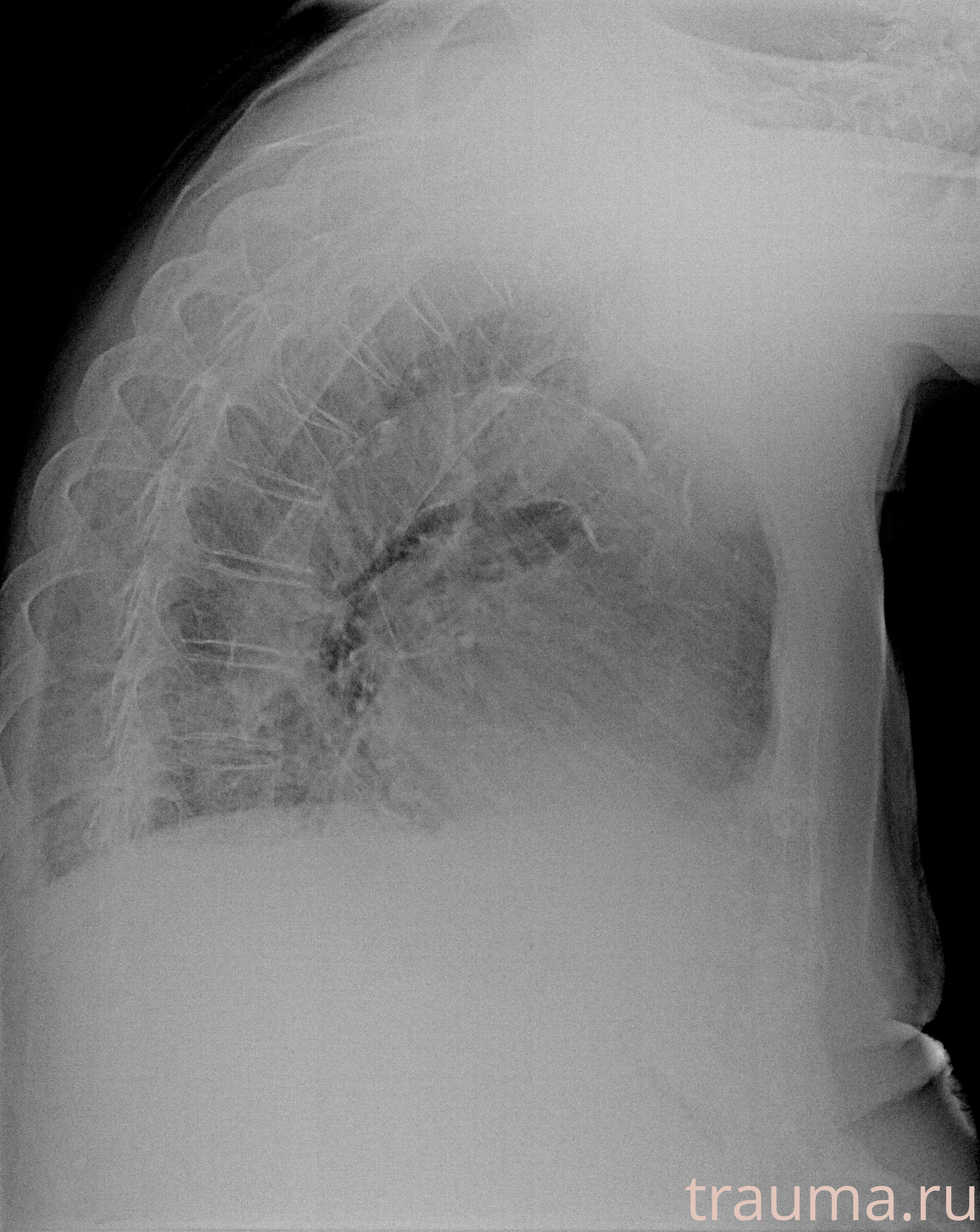Рентген на дому: по вашему адресу приезжает врач-рентгенолог, травматолог-ортопед с мобильным рентгеновским аппаратом, проводит диагностику травмы или заболевания, делает необходимые рентгенограммы, дает рекомендации по дальнейшему лечению. Получить качественные снимки в домашних условиях возможно благодаря уникальной методике, разработанной МосРентген Центром для института  Склифосовского
