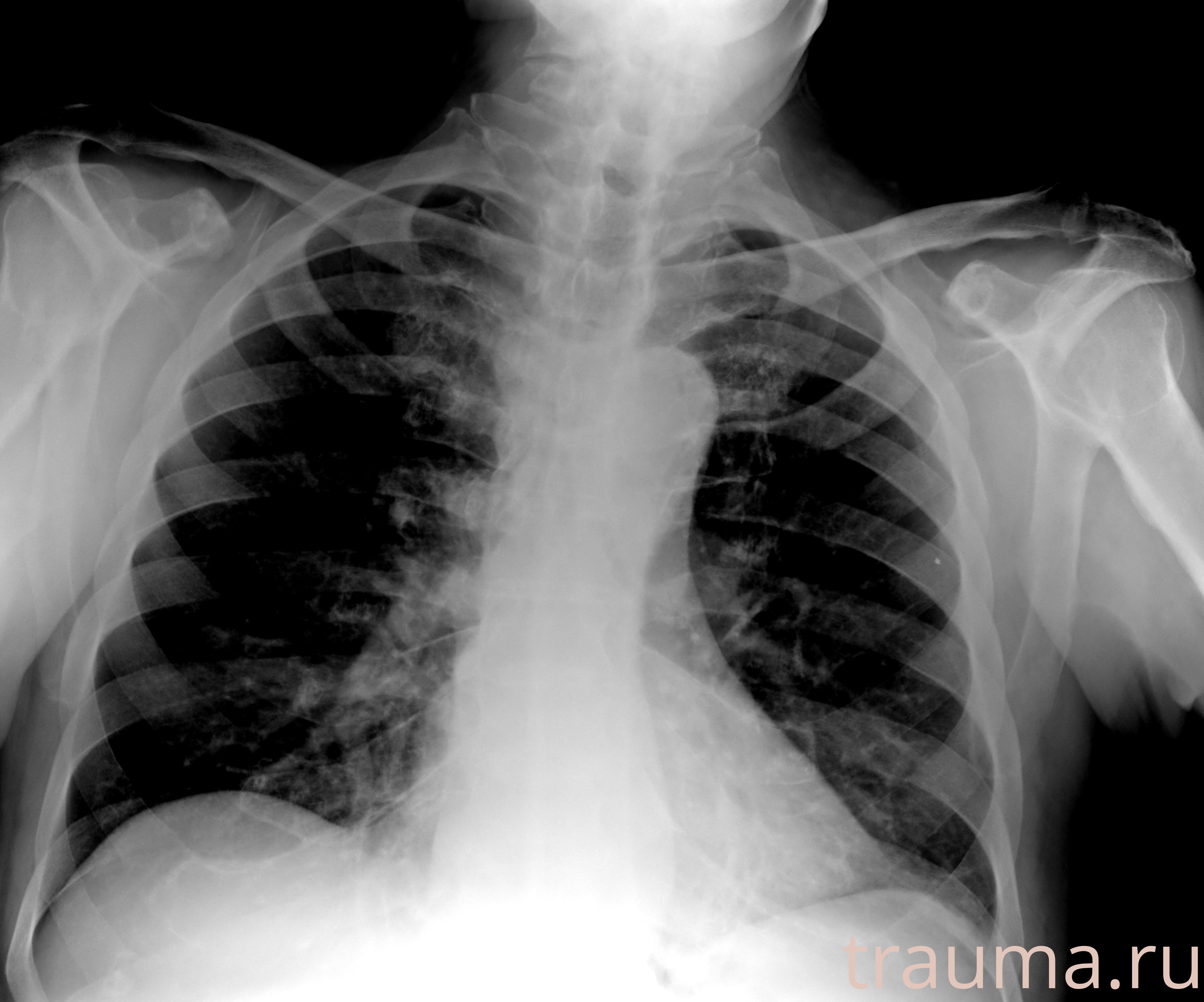 Рентген на дому: по вашему адресу приезжает врач-рентгенолог, травматолог-ортопед с мобильным рентгеновским аппаратом, проводит диагностику травмы или заболевания, делает необходимые рентгенограммы, дает рекомендации по дальнейшему лечению. Получить качественные снимки в домашних условиях возможно благодаря уникальной методике, разработанной МосРентген Центром для института  Склифосовского